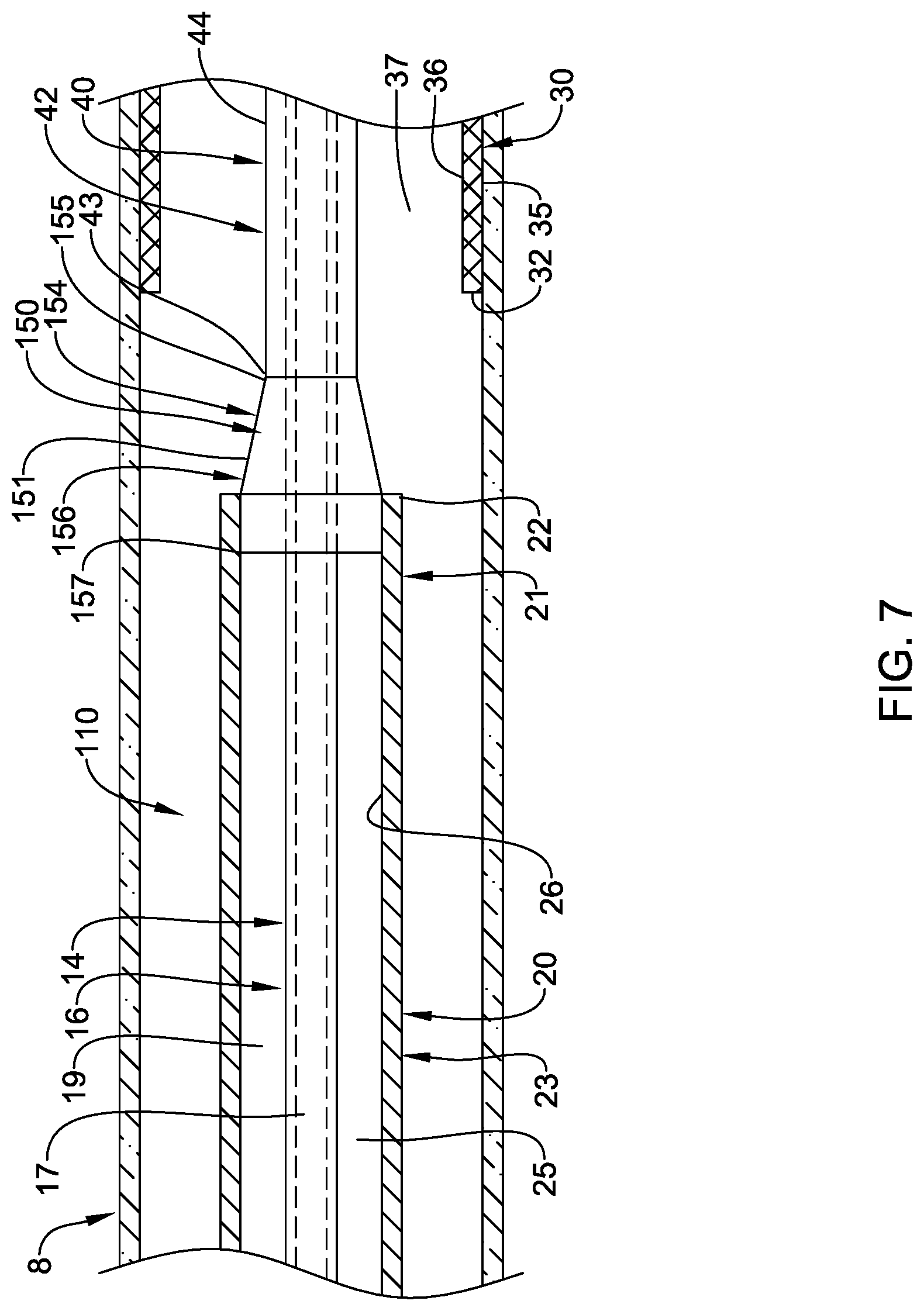 Patent US12090074 Figure 7 – Stent delivery systems