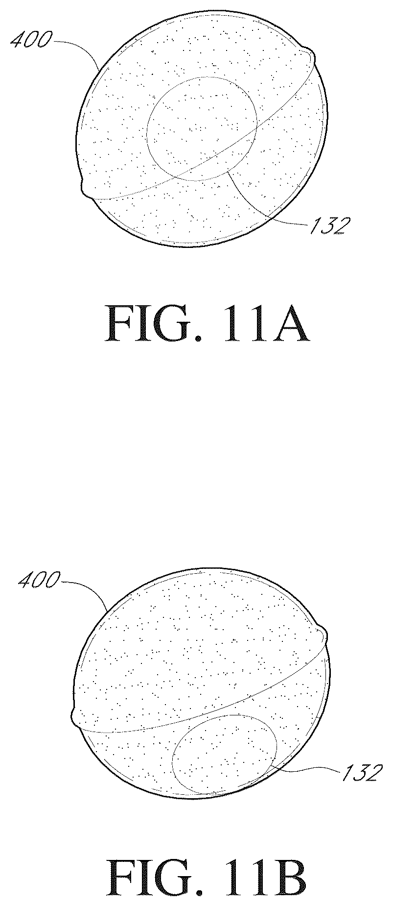 Patent US12090075 Figure 5 – Intragastric device