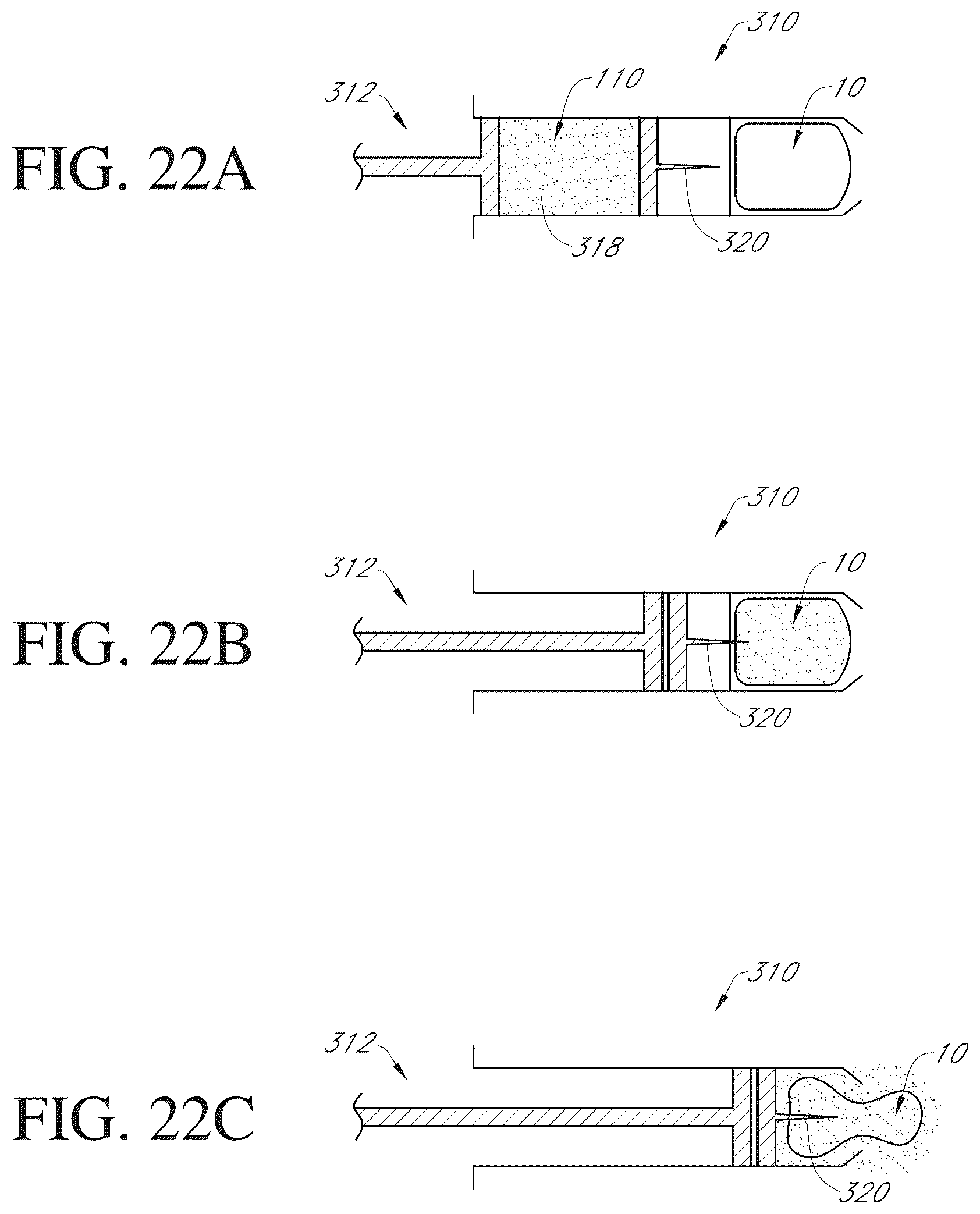 Patent US12090075 Figure 12 – Intragastric device
