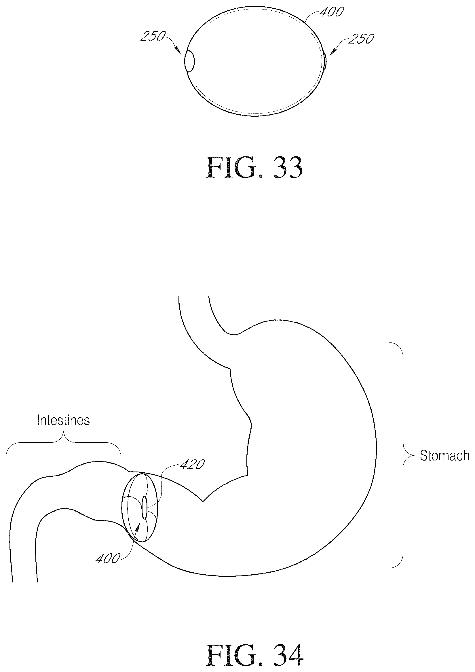Patent US12090075 Figure 17 – Intragastric device