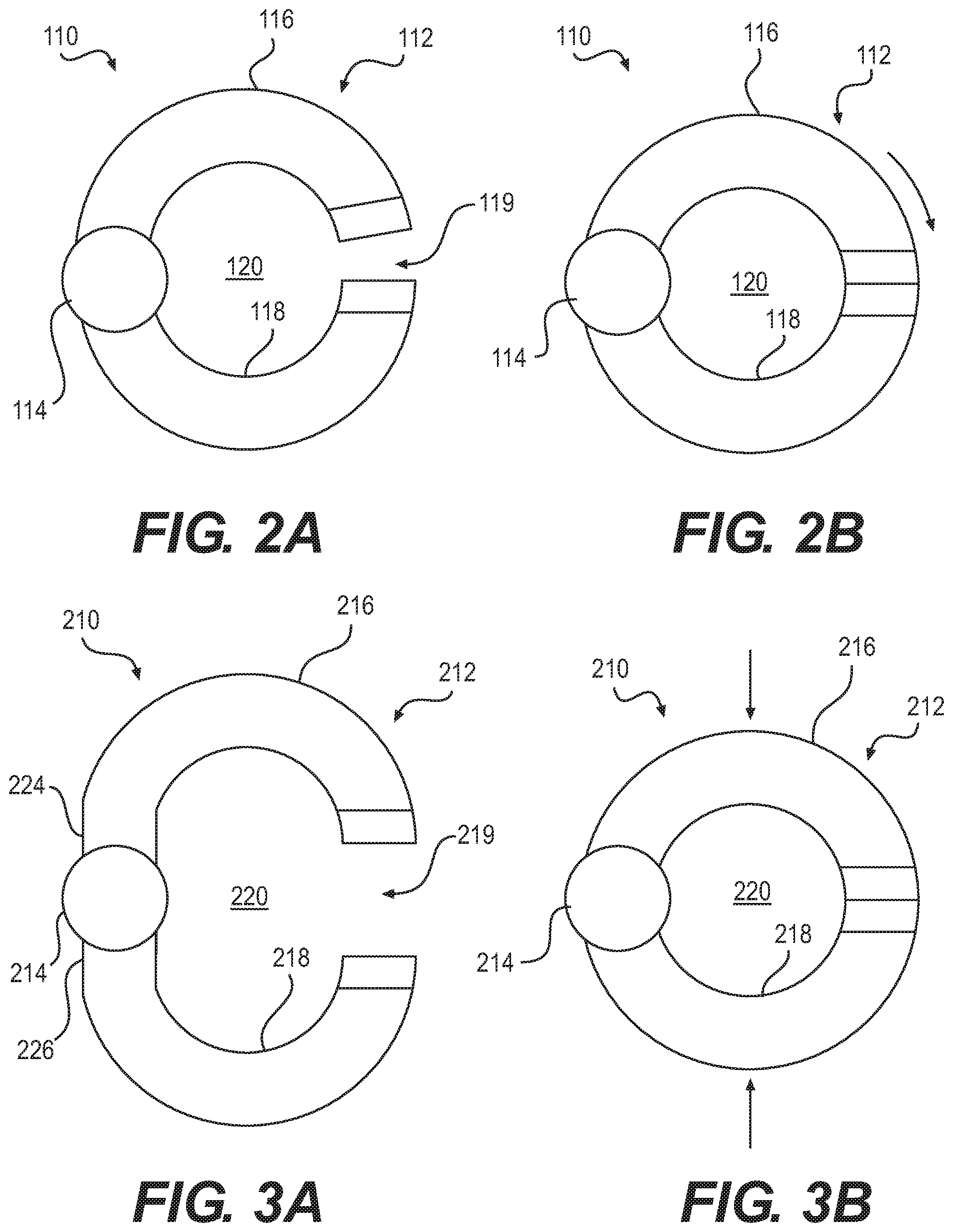 Patent US12090076 Figure 2 – Devices and related methods for gastrectomies