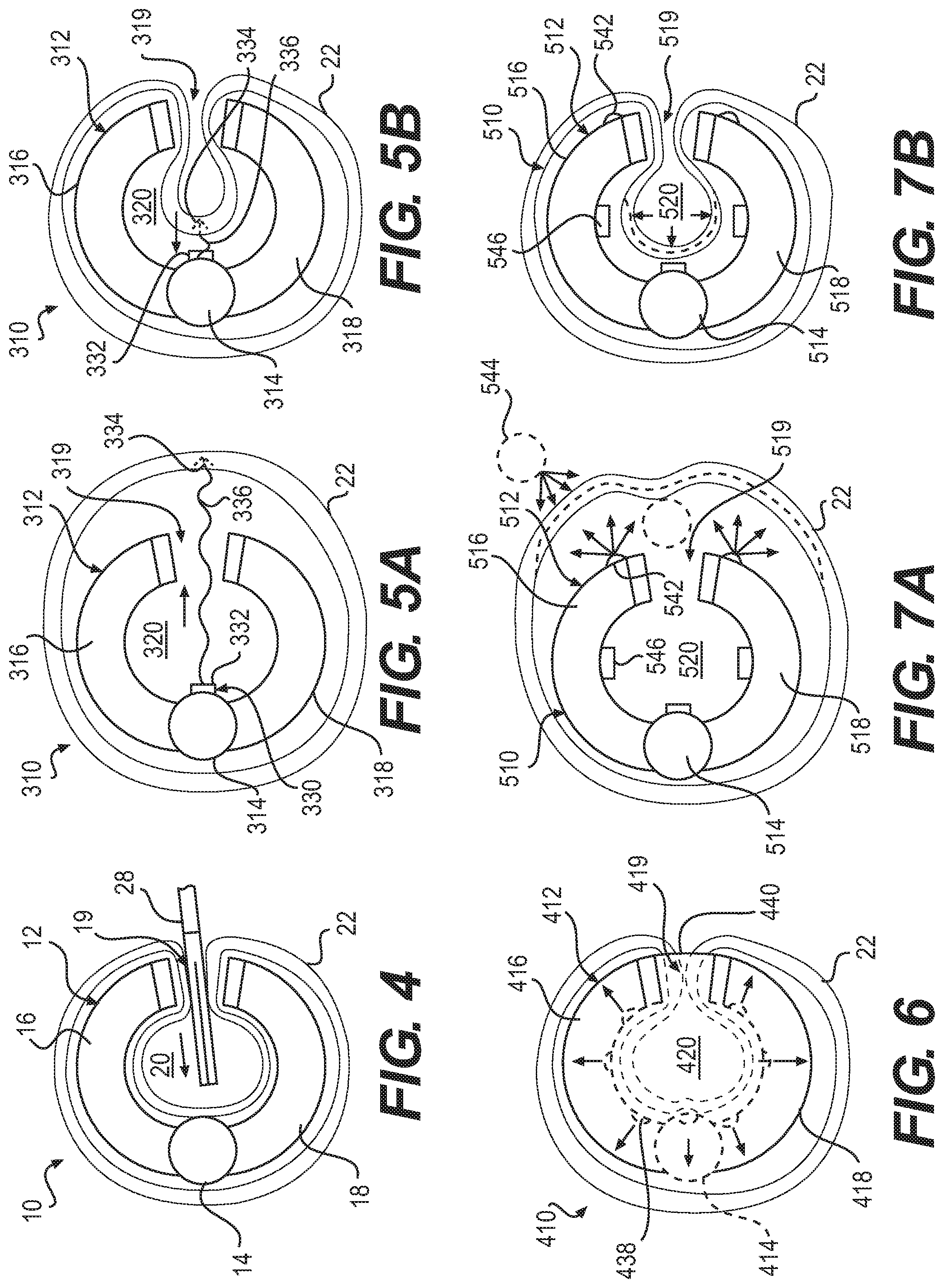 Patent US12090076 Figure 3 – Devices and related methods for gastrectomies