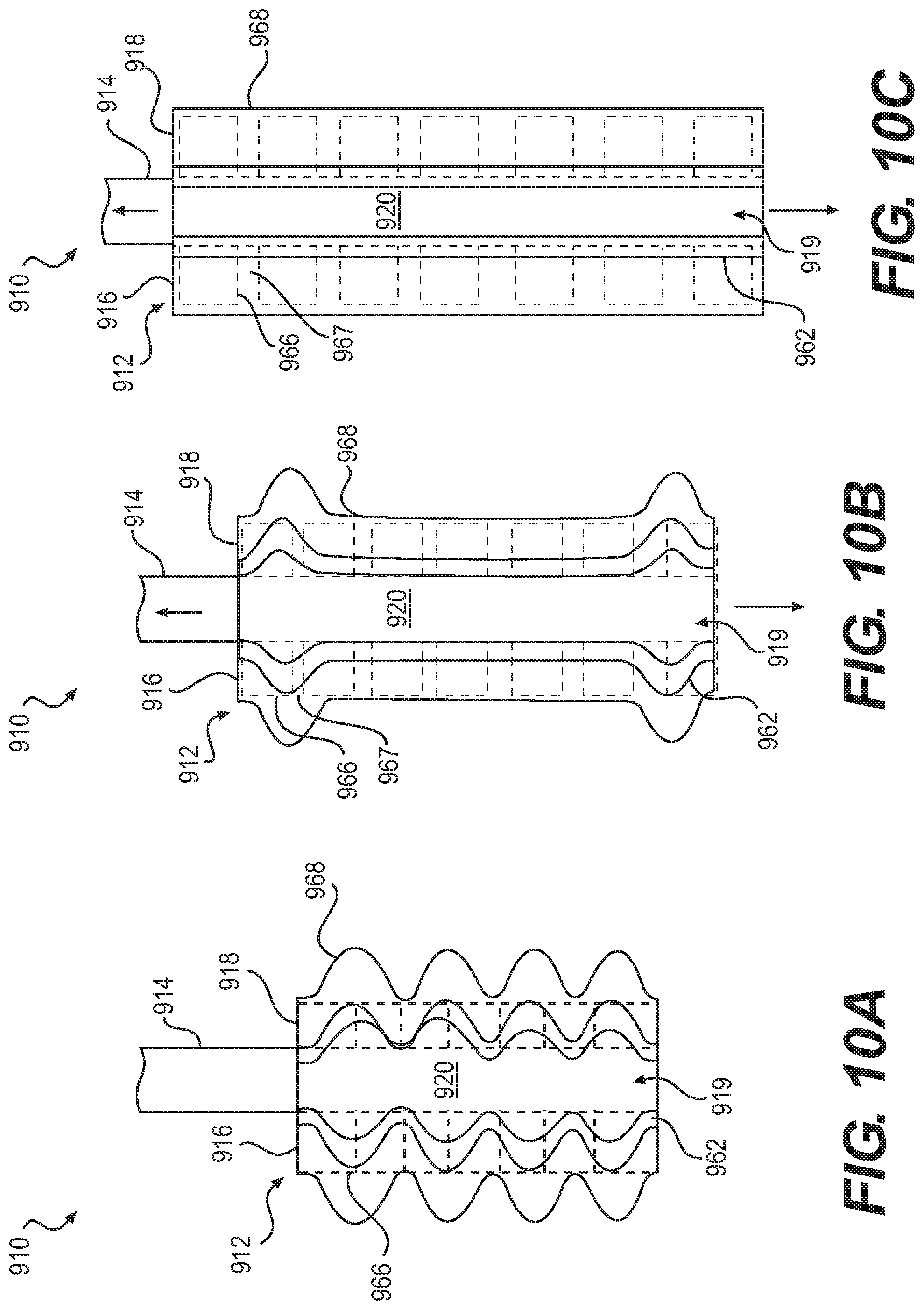 Patent US12090076 Figure 5 – Devices and related methods for gastrectomies