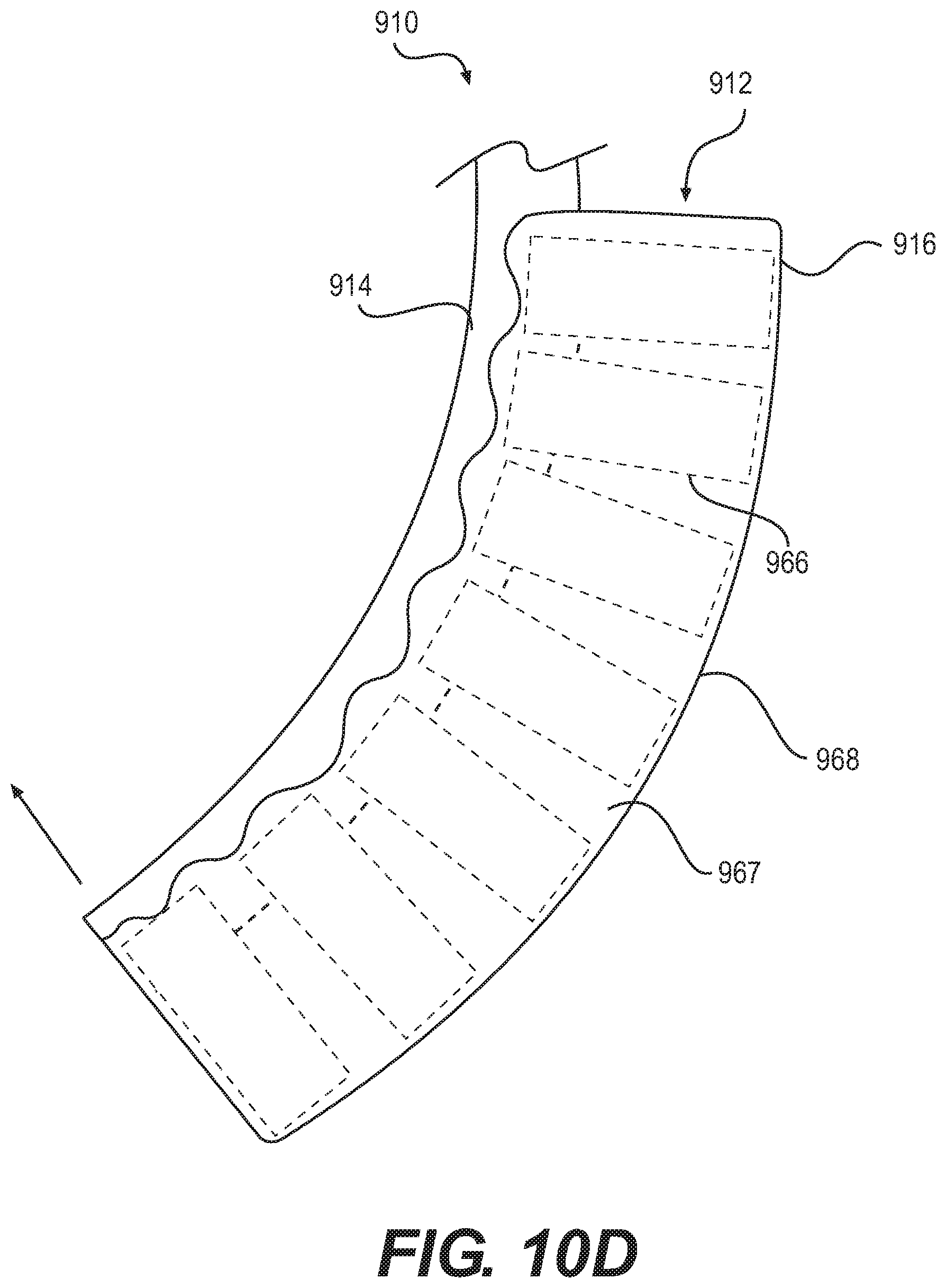Patent US12090076 Figure 6 – Devices and related methods for gastrectomies