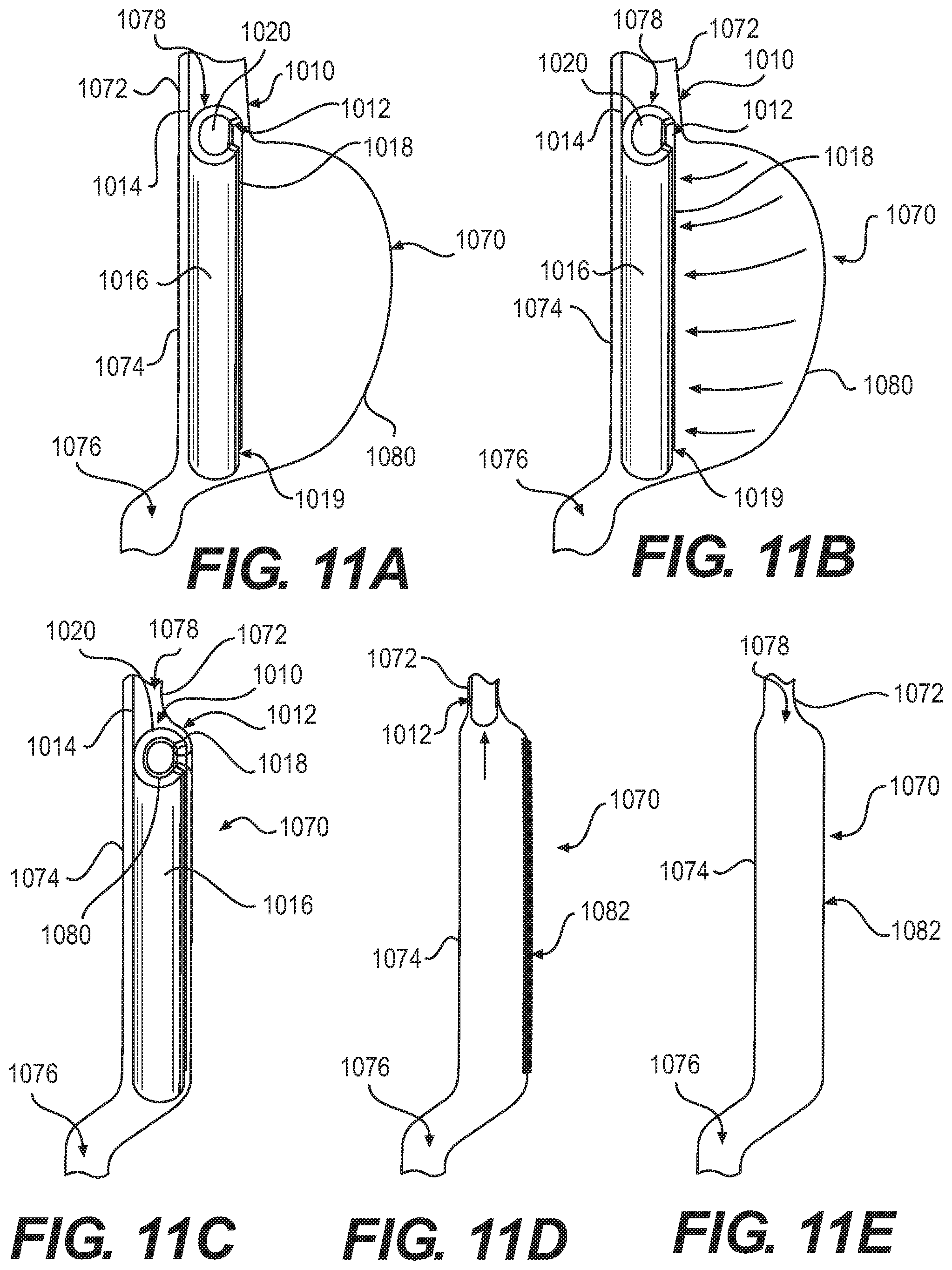 Patent US12090076 Figure 7 – Devices and related methods for gastrectomies