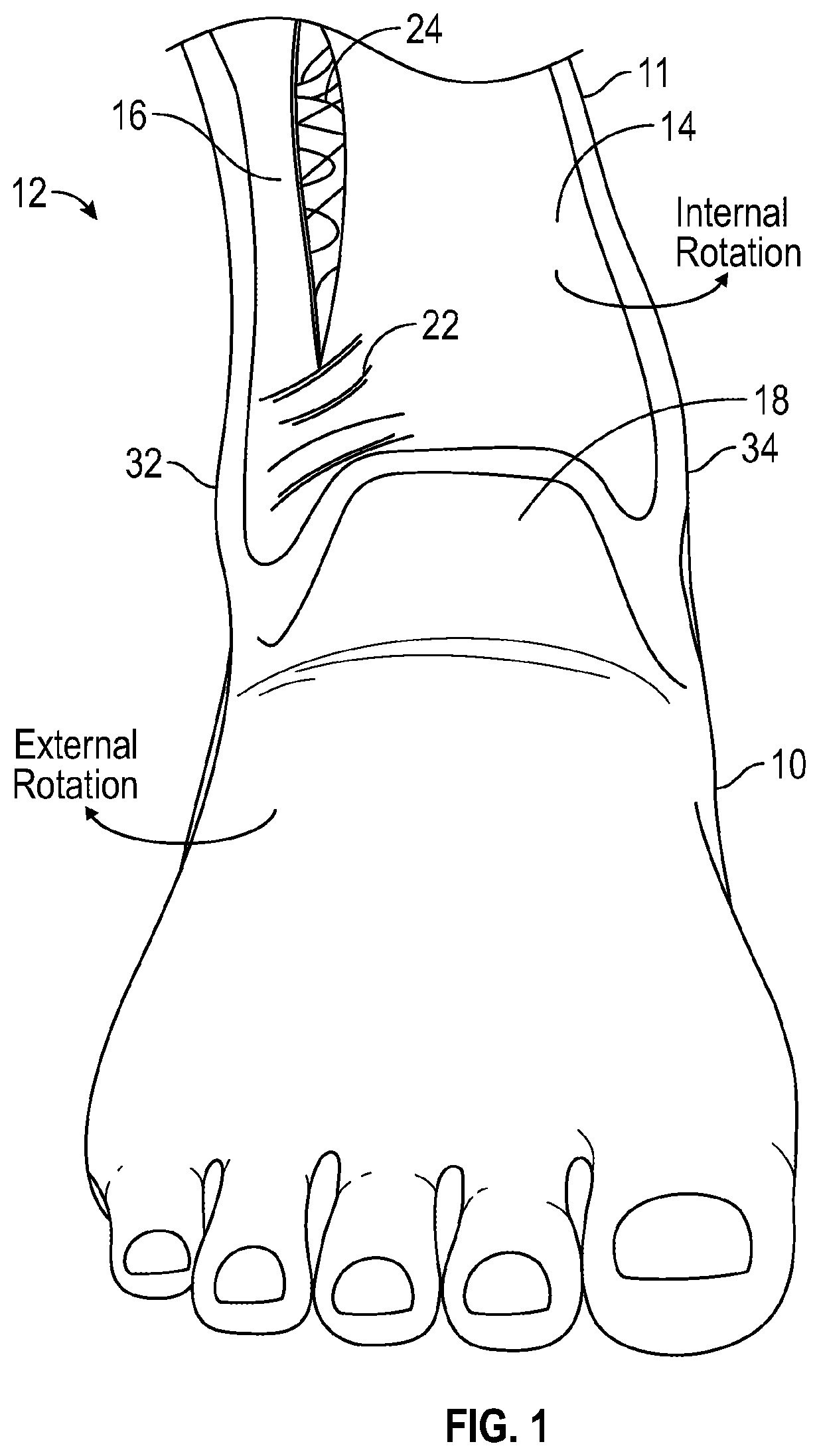 Patent US12090077 Figure 1 – Ankle brace