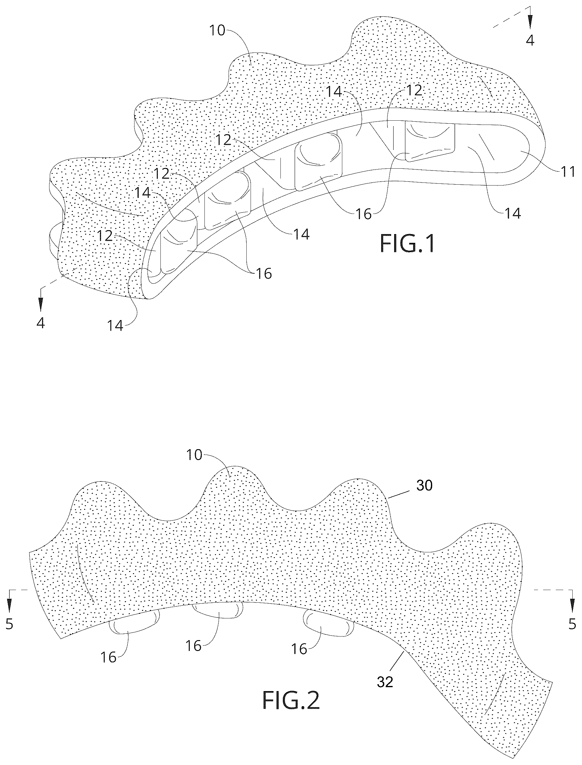 Patent US12090078 Figure 1 – Adjustable toe separator device and method of improving foot functioning