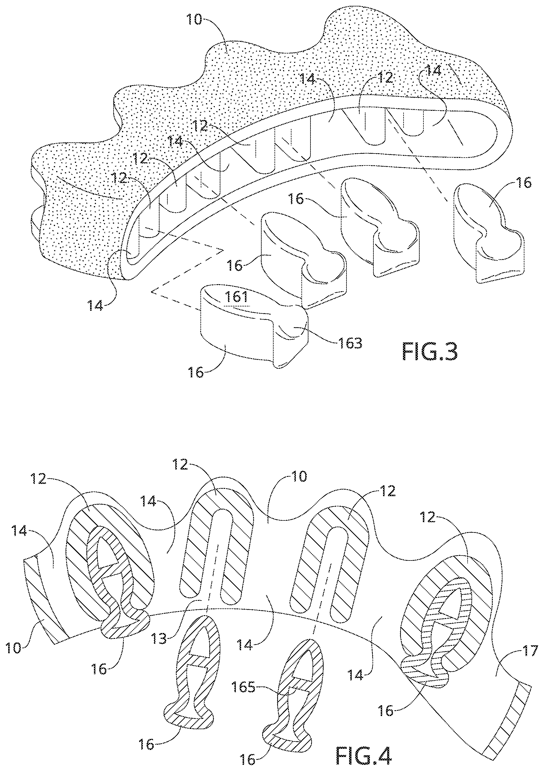 Patent US12090078 Figure 2 – Adjustable toe separator device and method of improving foot functioning