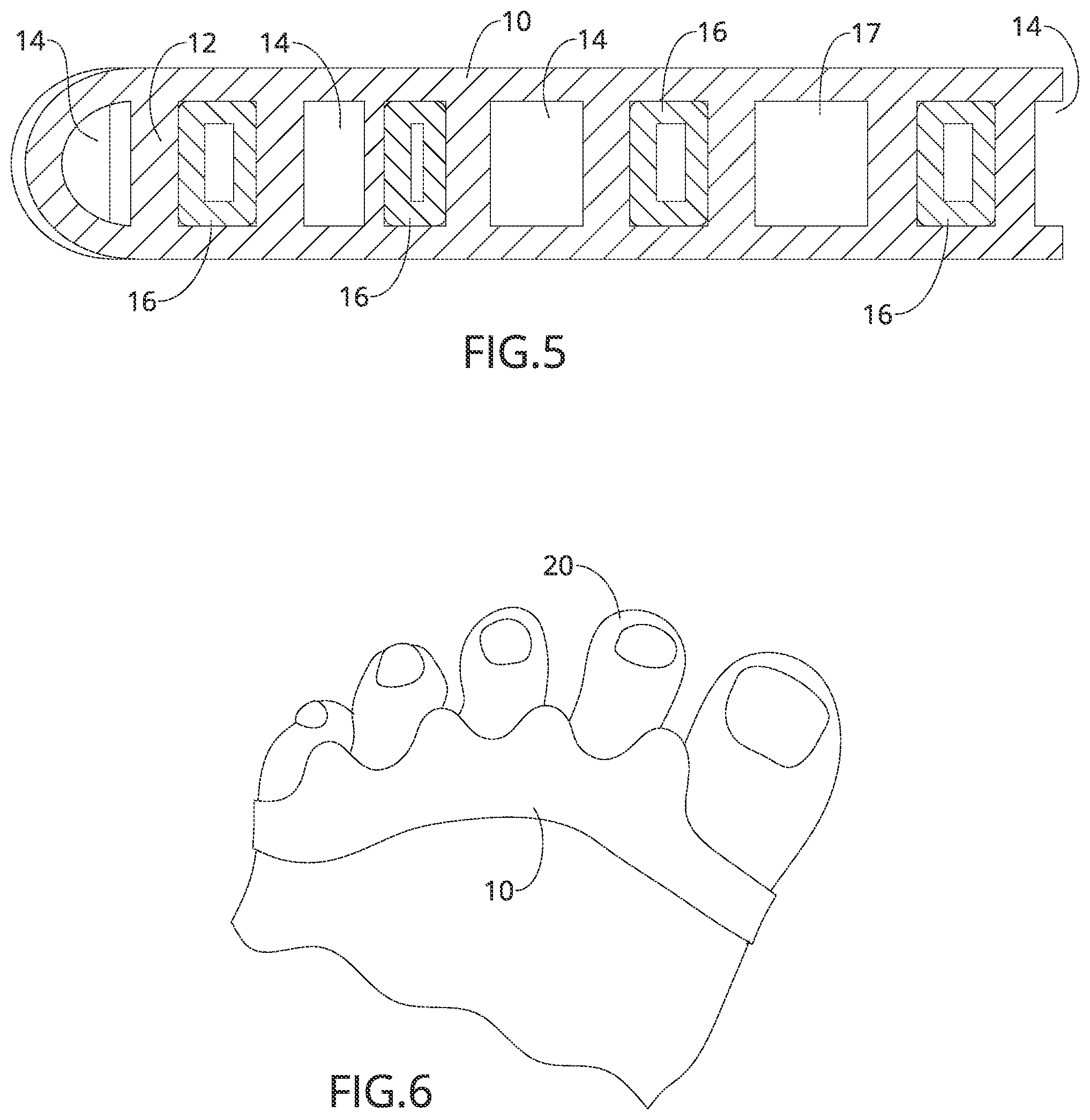 Patent US12090078 Figure 3 – Adjustable toe separator device and method of improving foot functioning