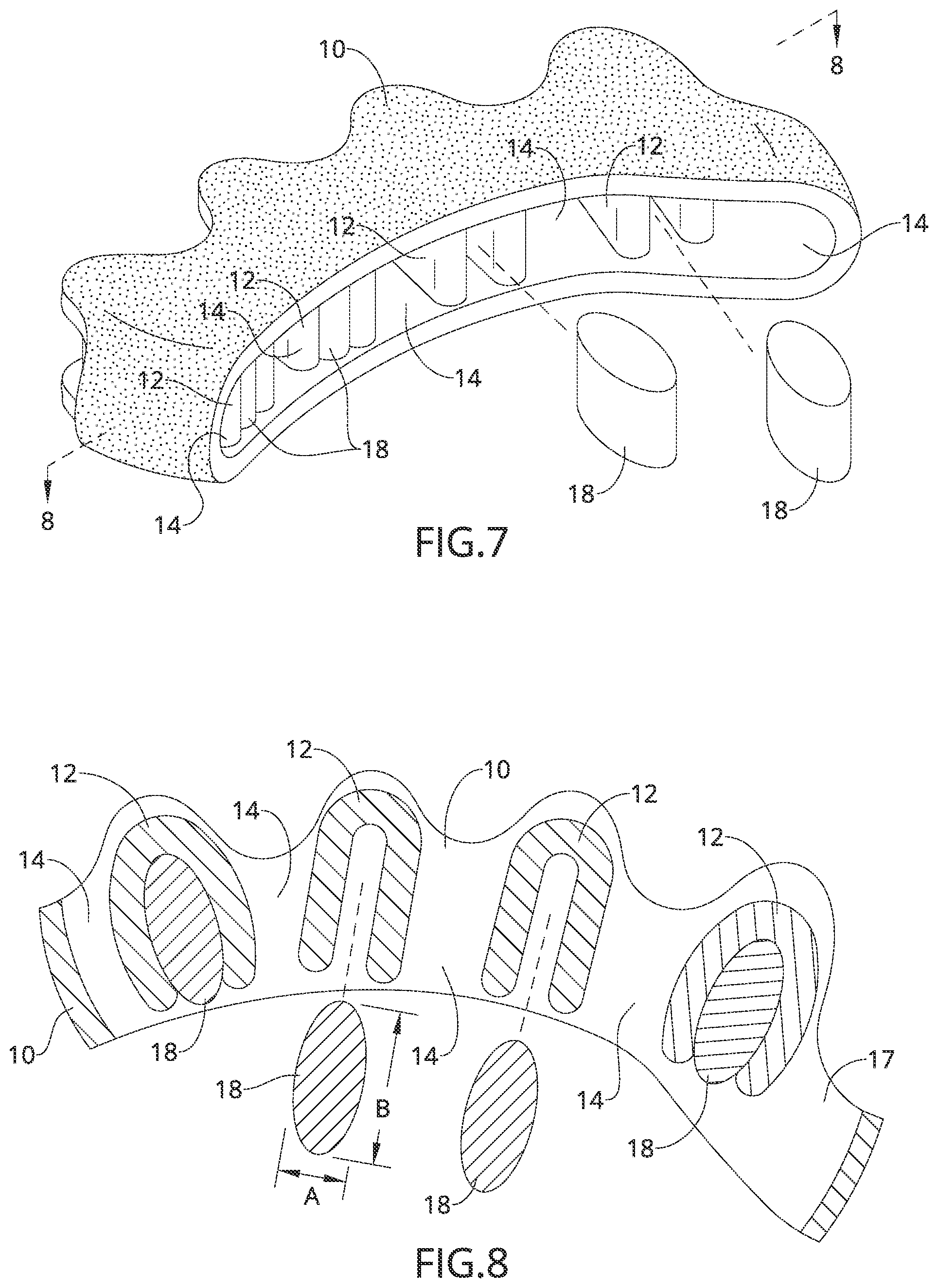 Patent US12090078 Figure 4 – Adjustable toe separator device and method of improving foot functioning