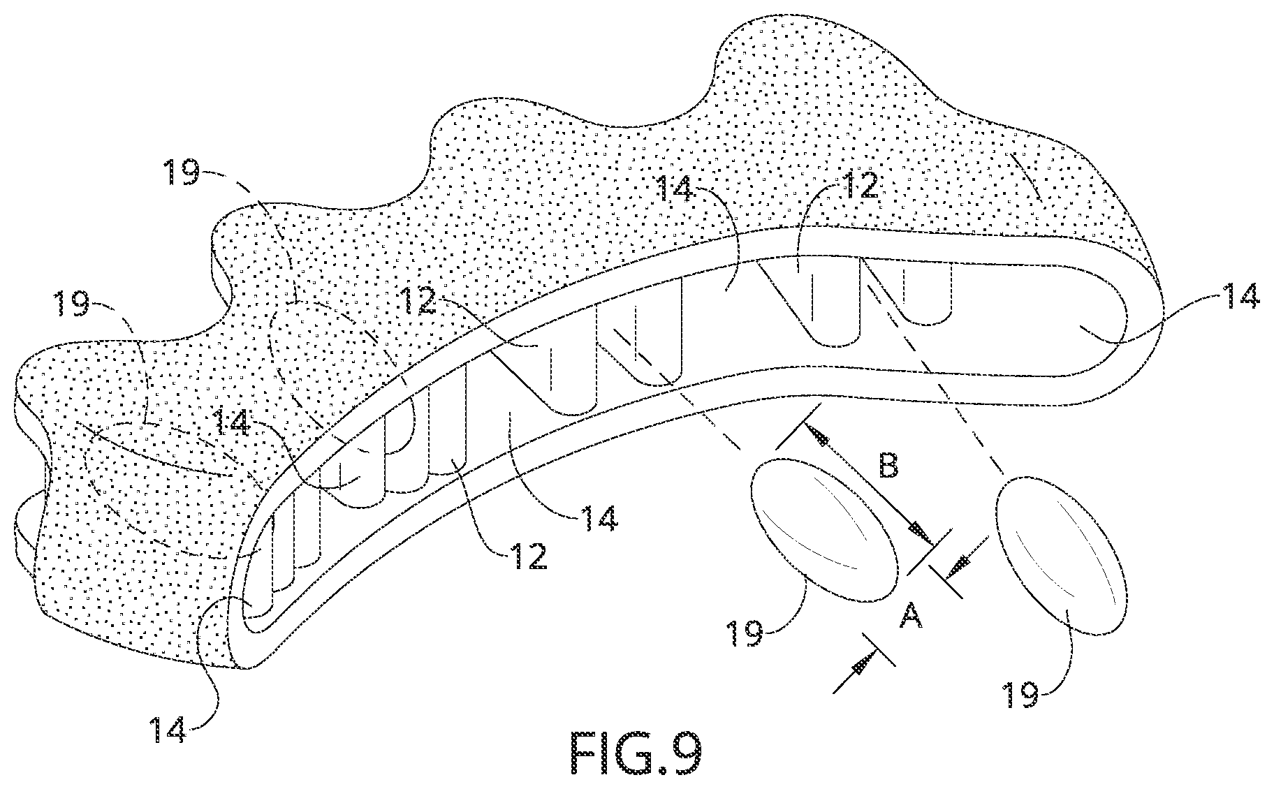 Patent US12090078 Figure 5 – Adjustable toe separator device and method of improving foot functioning