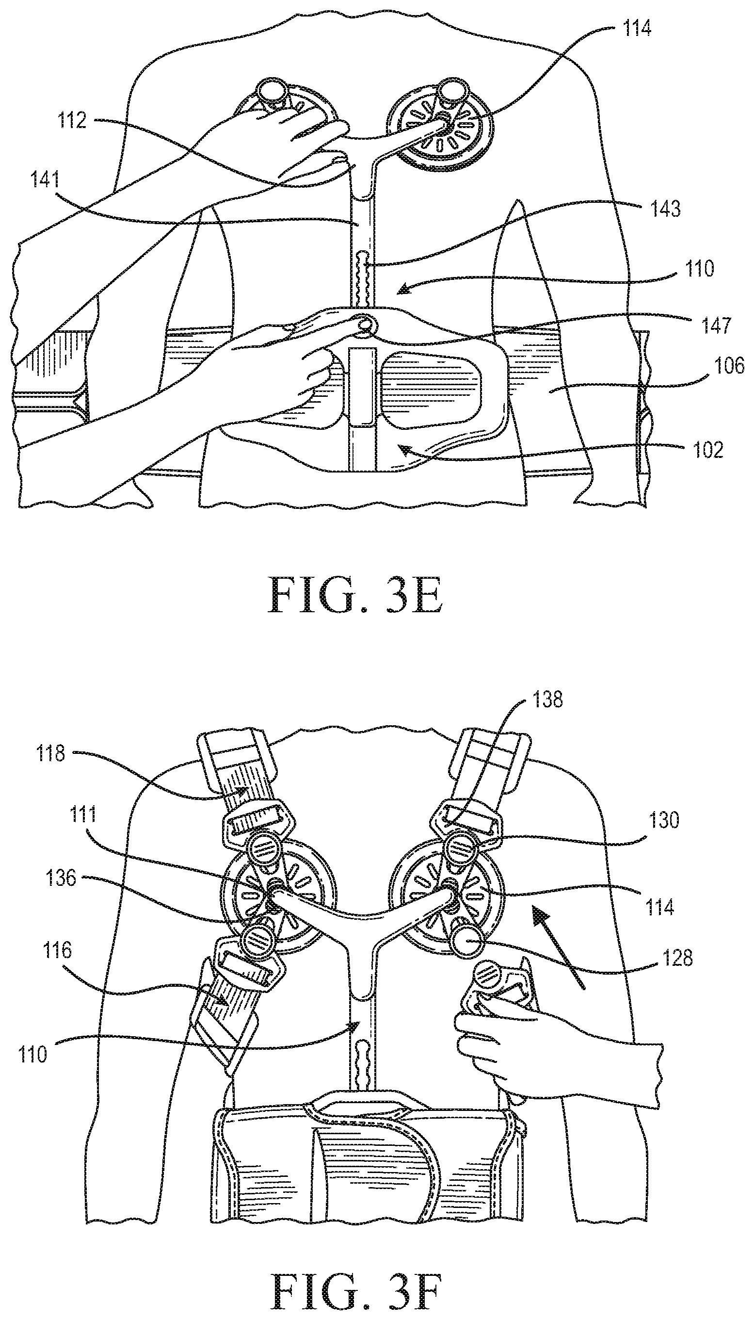 Patent US12090079 Figure 6 – Thoracic lumbar sacral orthosis attachment