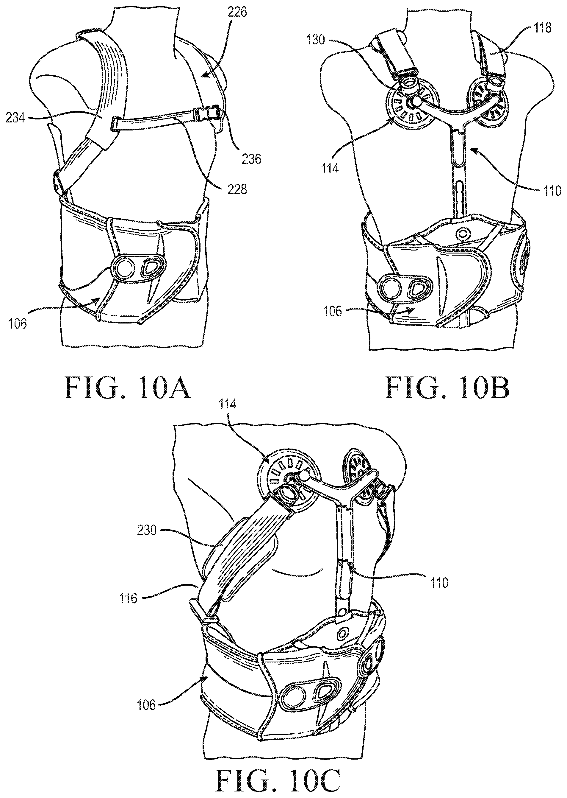 Patent US12090079 Figure 17 – Thoracic lumbar sacral orthosis attachment