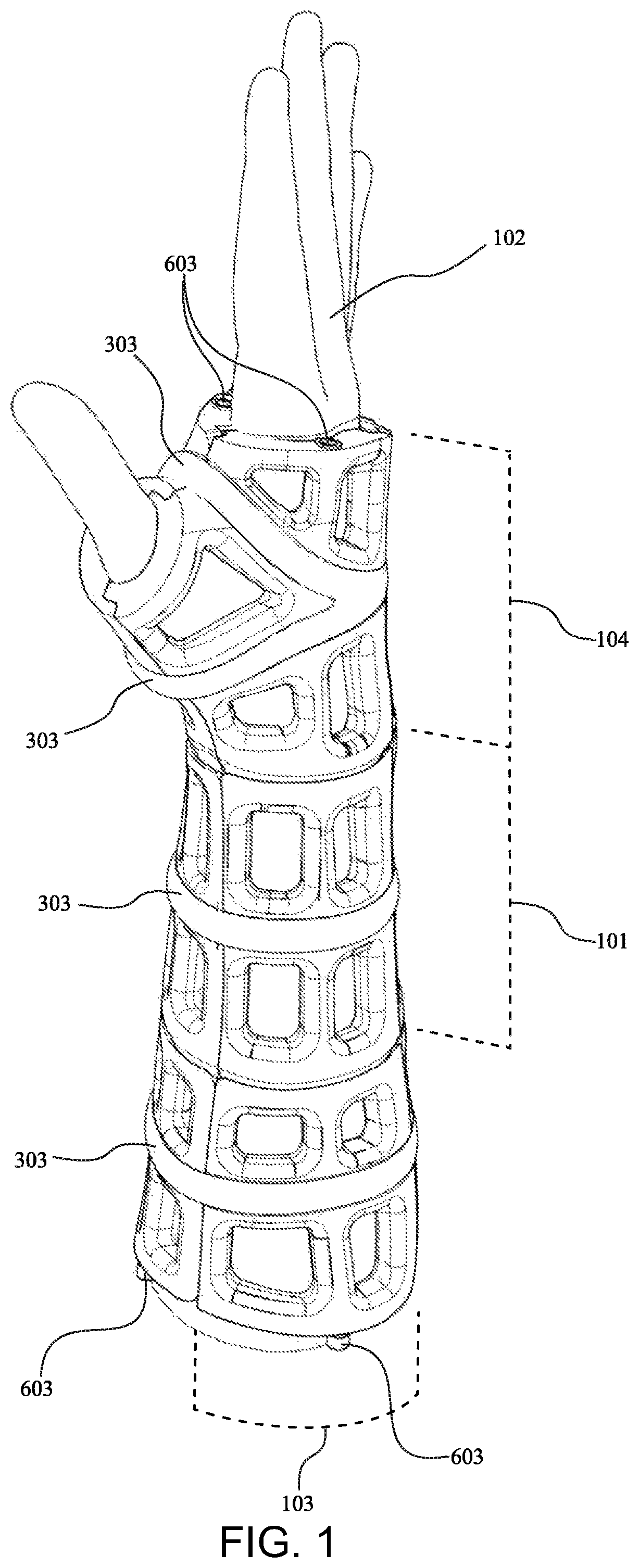 Patent US12090080 Figure 1 – Adaptive three-dimensional orthoses and methods for their manufacture and use