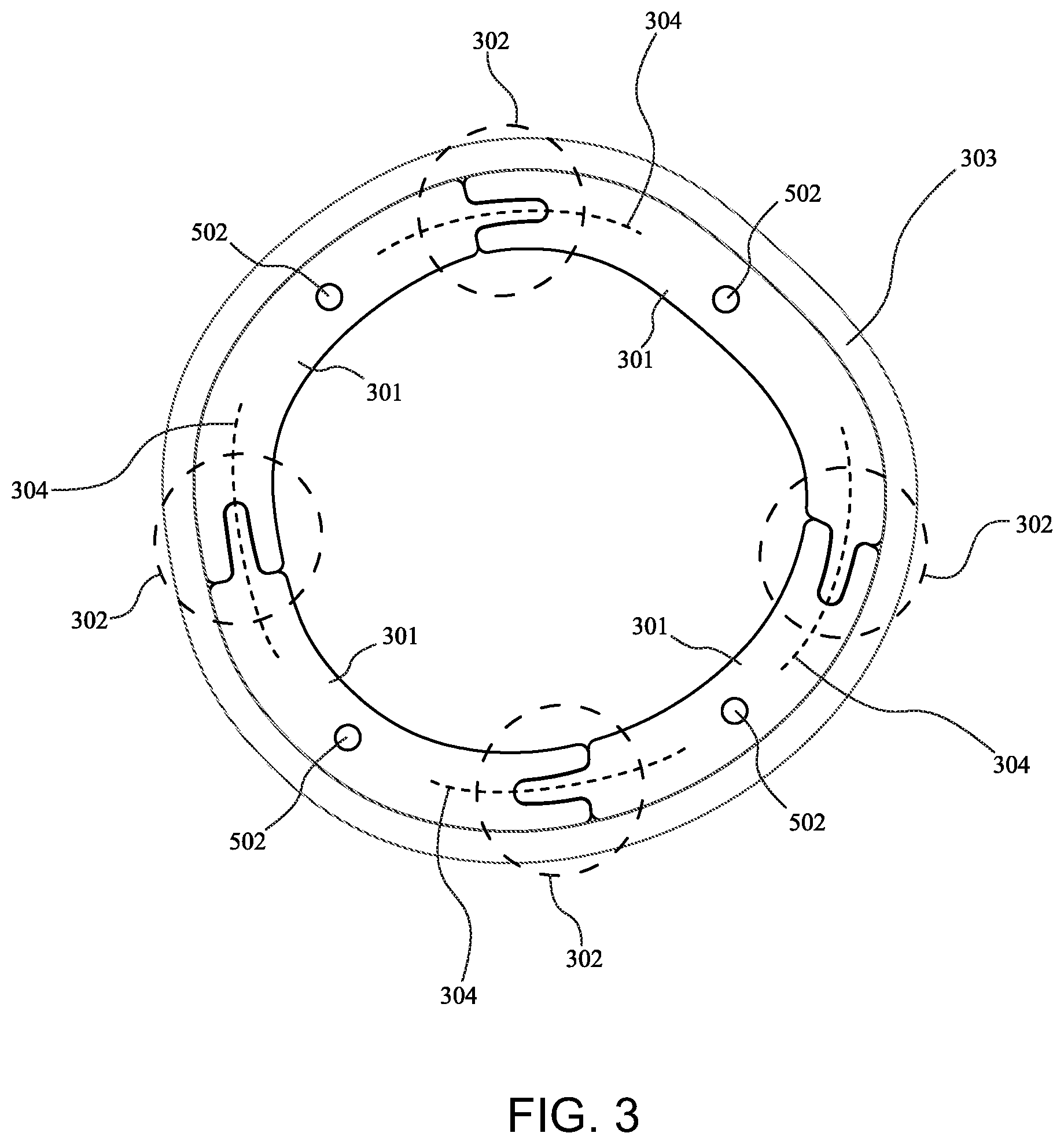 Patent US12090080 Figure 3 – Adaptive three-dimensional orthoses and methods for their manufacture and use