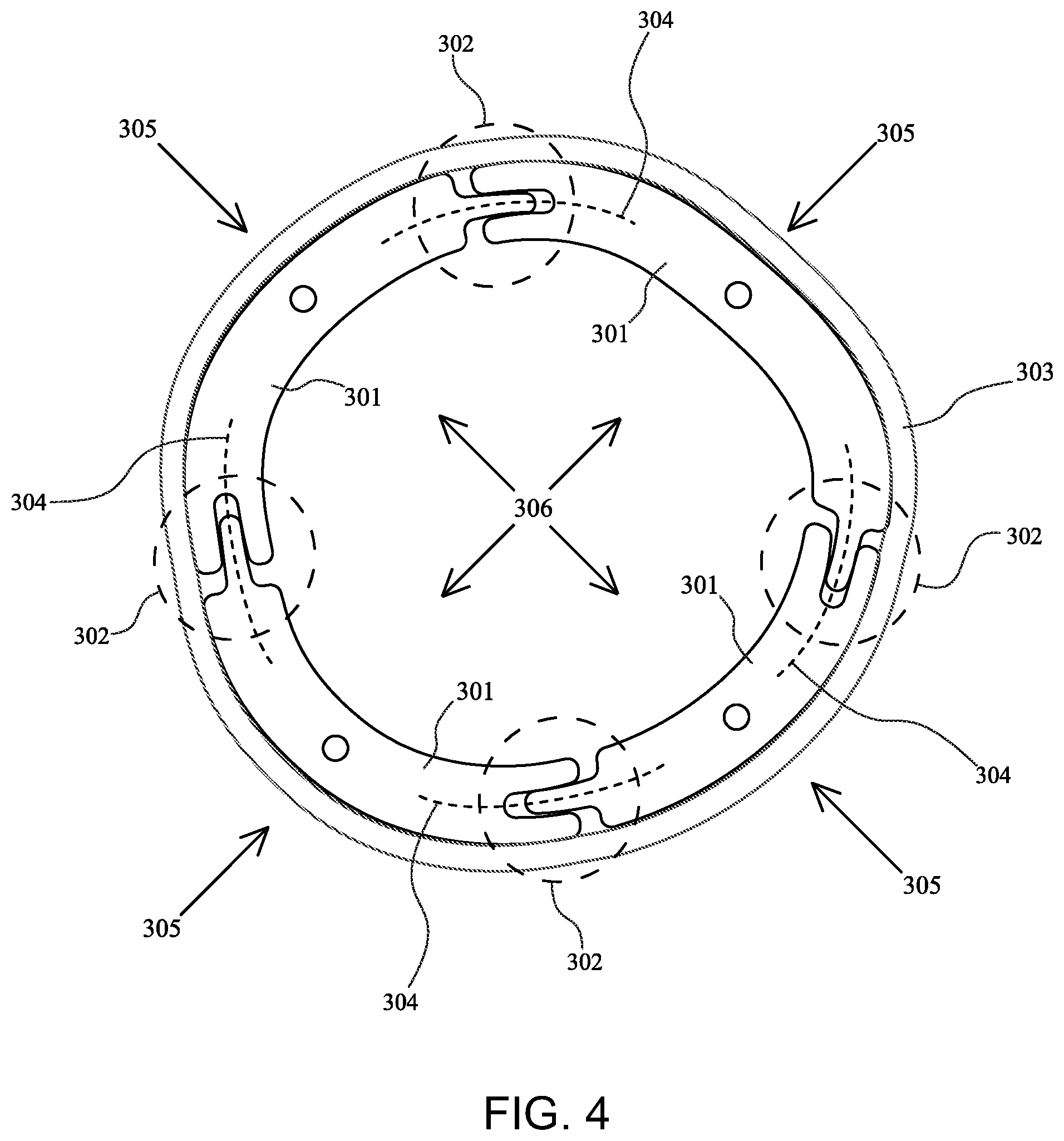 Patent US12090080 Figure 4 – Adaptive three-dimensional orthoses and methods for their manufacture and use