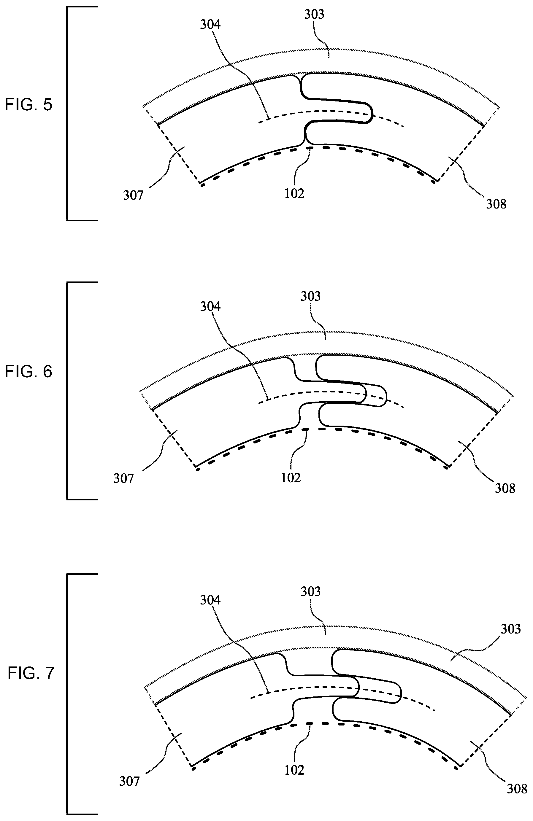 Patent US12090080 Figure 5 – Adaptive three-dimensional orthoses and methods for their manufacture and use