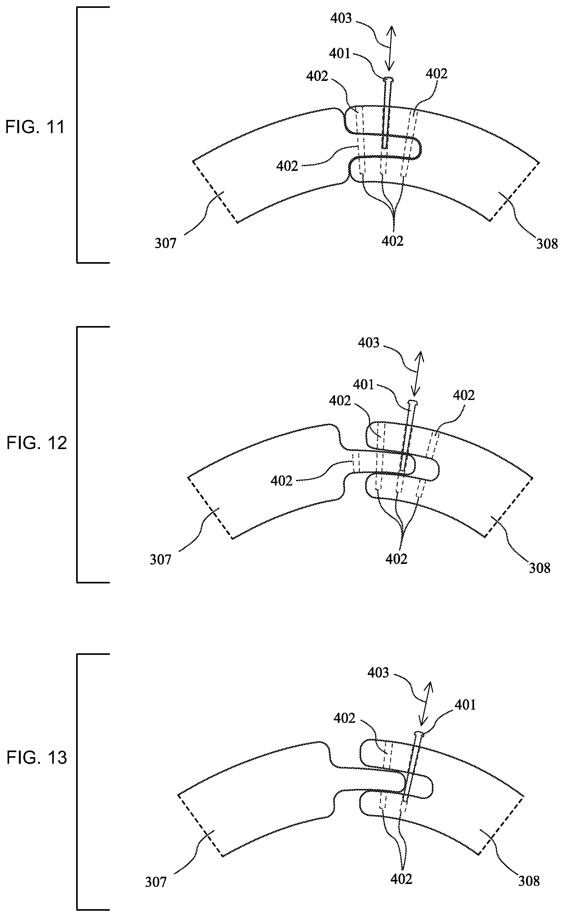 Patent US12090080 Figure 7 – Adaptive three-dimensional orthoses and methods for their manufacture and use