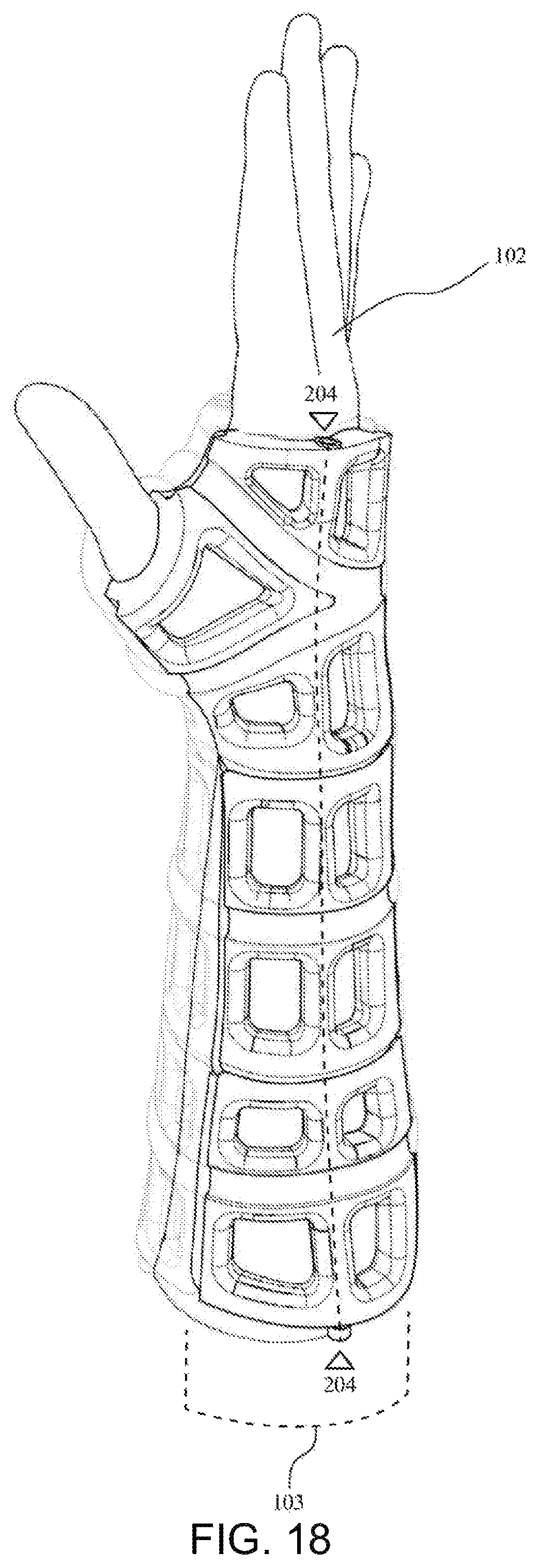 Patent US12090080 Figure 9 – Adaptive three-dimensional orthoses and methods for their manufacture and use