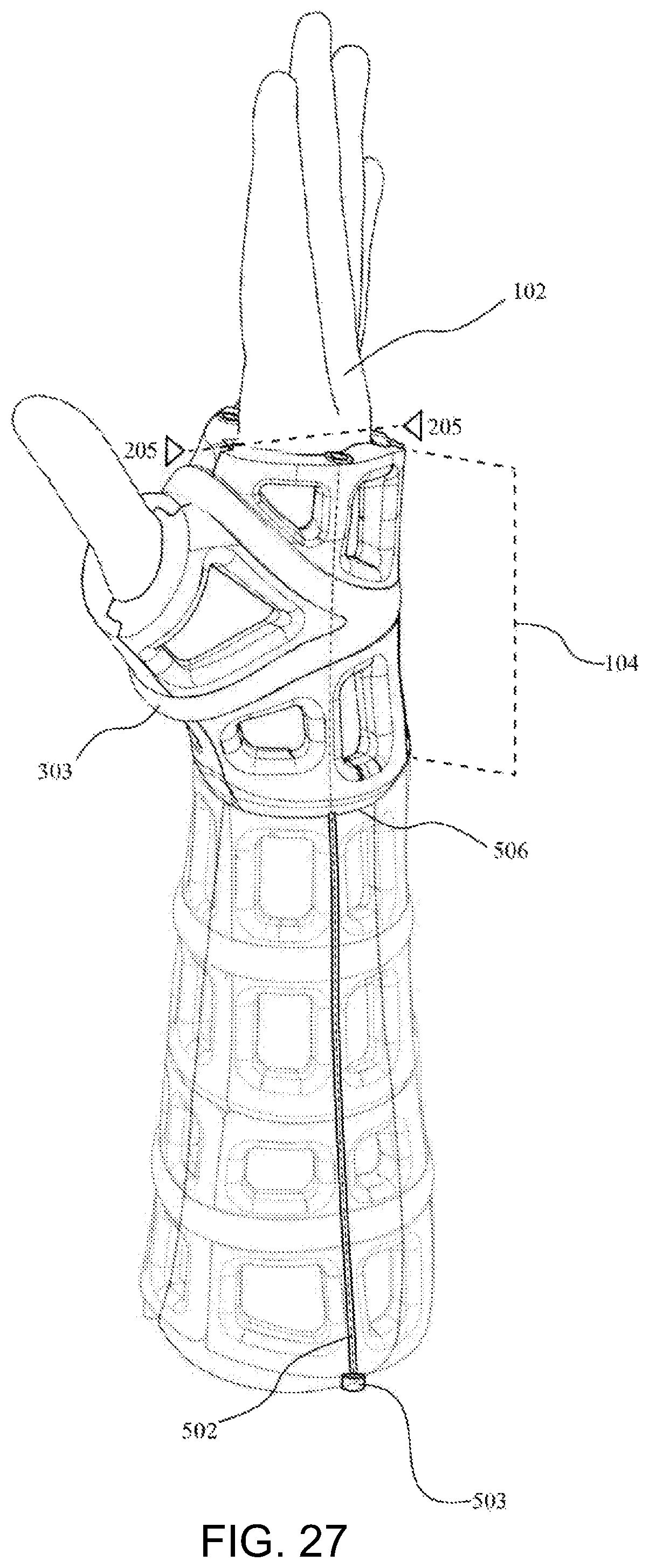 Patent US12090080 Figure 15 – Adaptive three-dimensional orthoses and methods for their manufacture and use