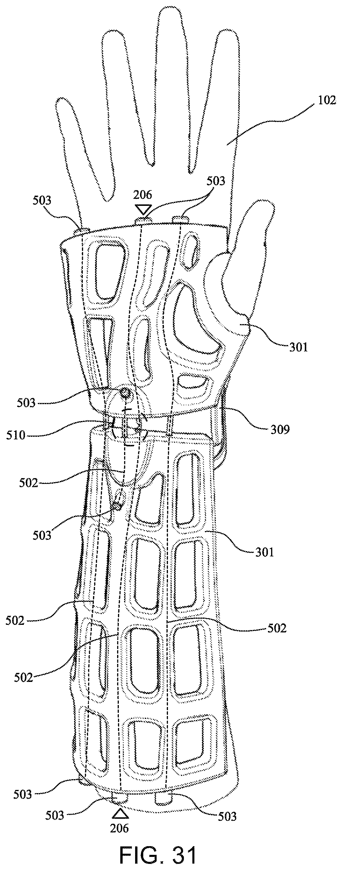 Patent US12090080 Figure 19 – Adaptive three-dimensional orthoses and methods for their manufacture and use