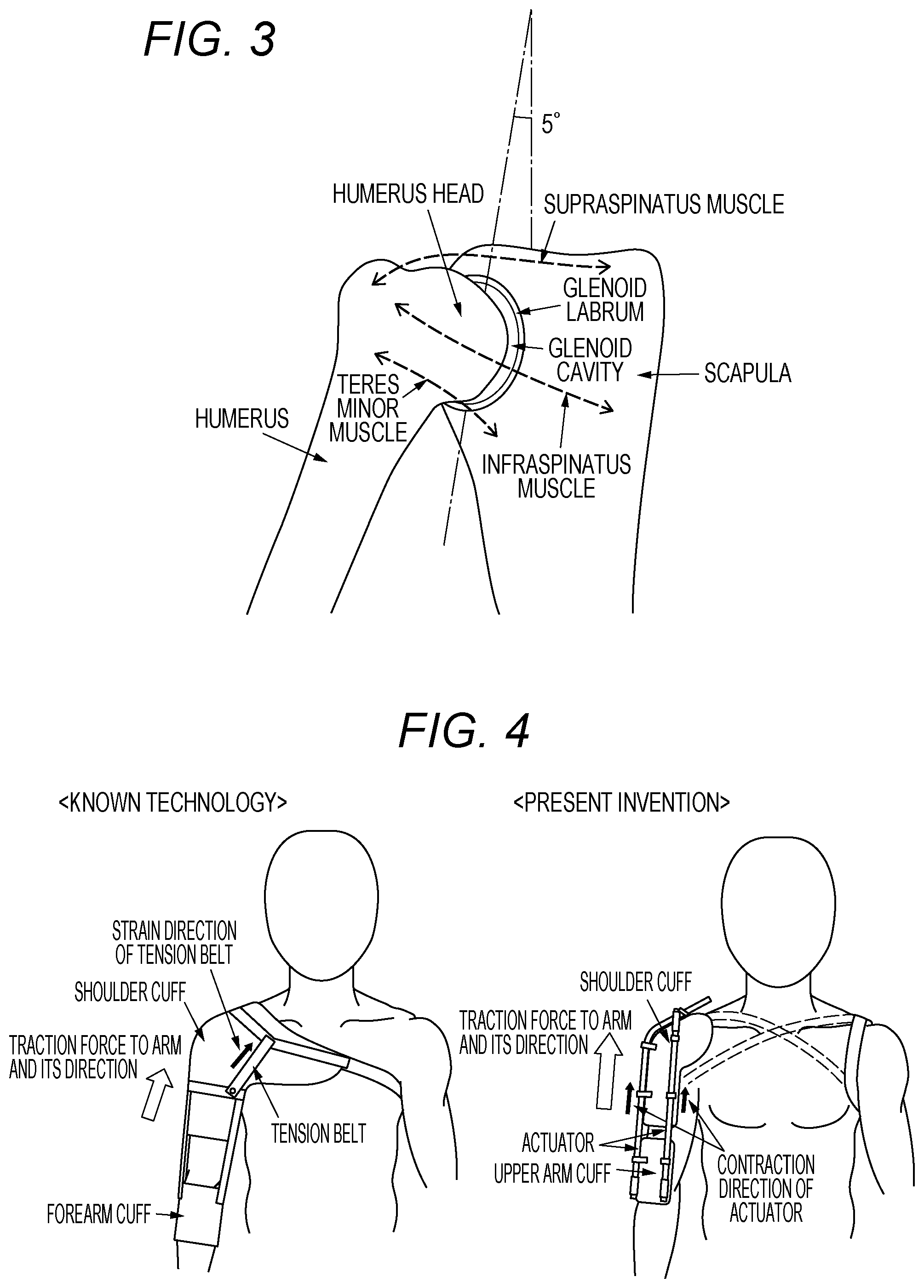 Patent US12090081 Figure 2 – Shoulder brace and rehabilitation method using shoulder brace
