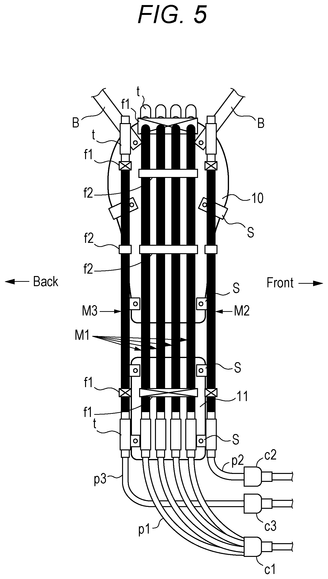 Patent US12090081 Figure 3 – Shoulder brace and rehabilitation method using shoulder brace