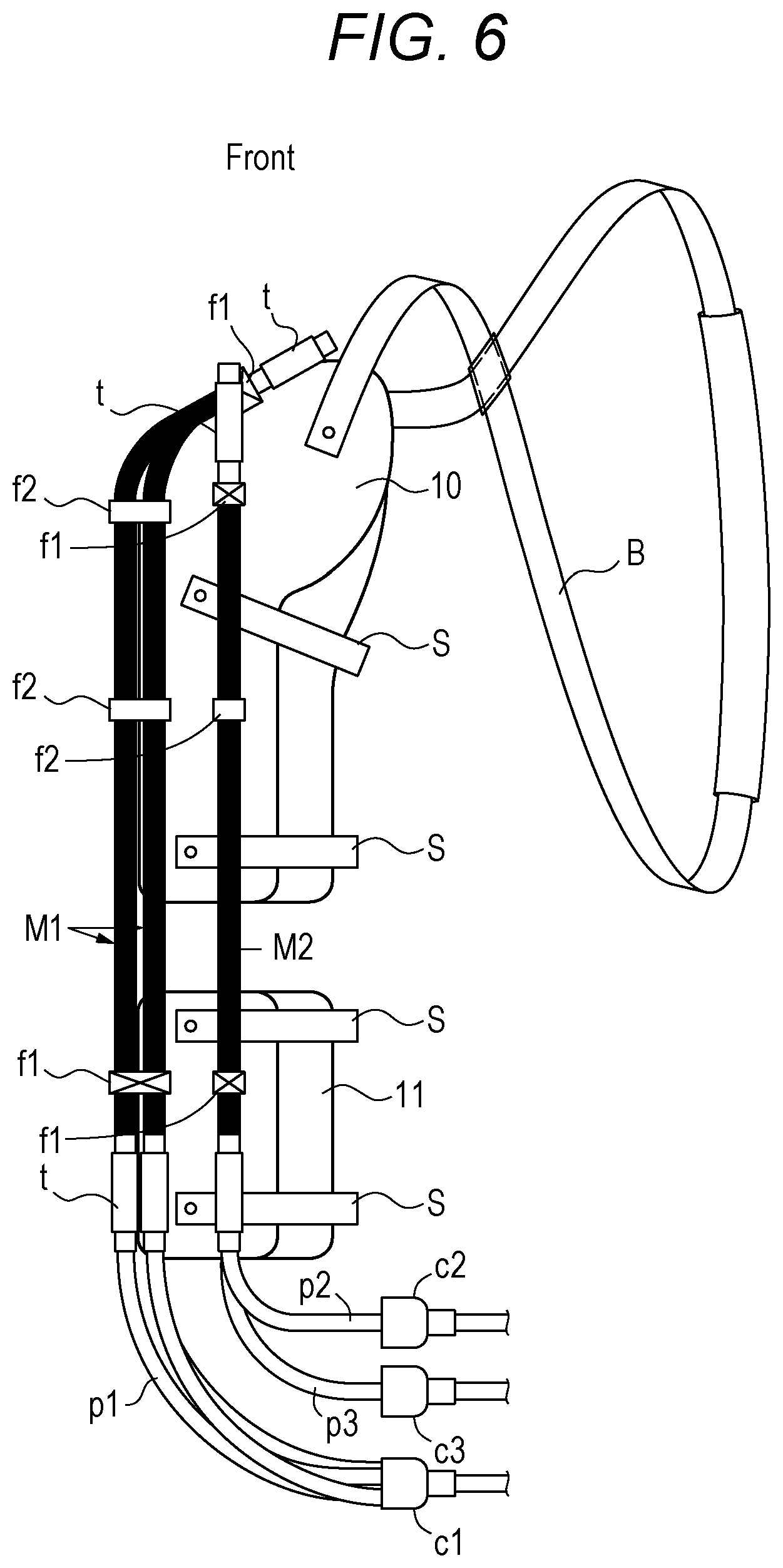 Patent US12090081 Figure 4 – Shoulder brace and rehabilitation method using shoulder brace