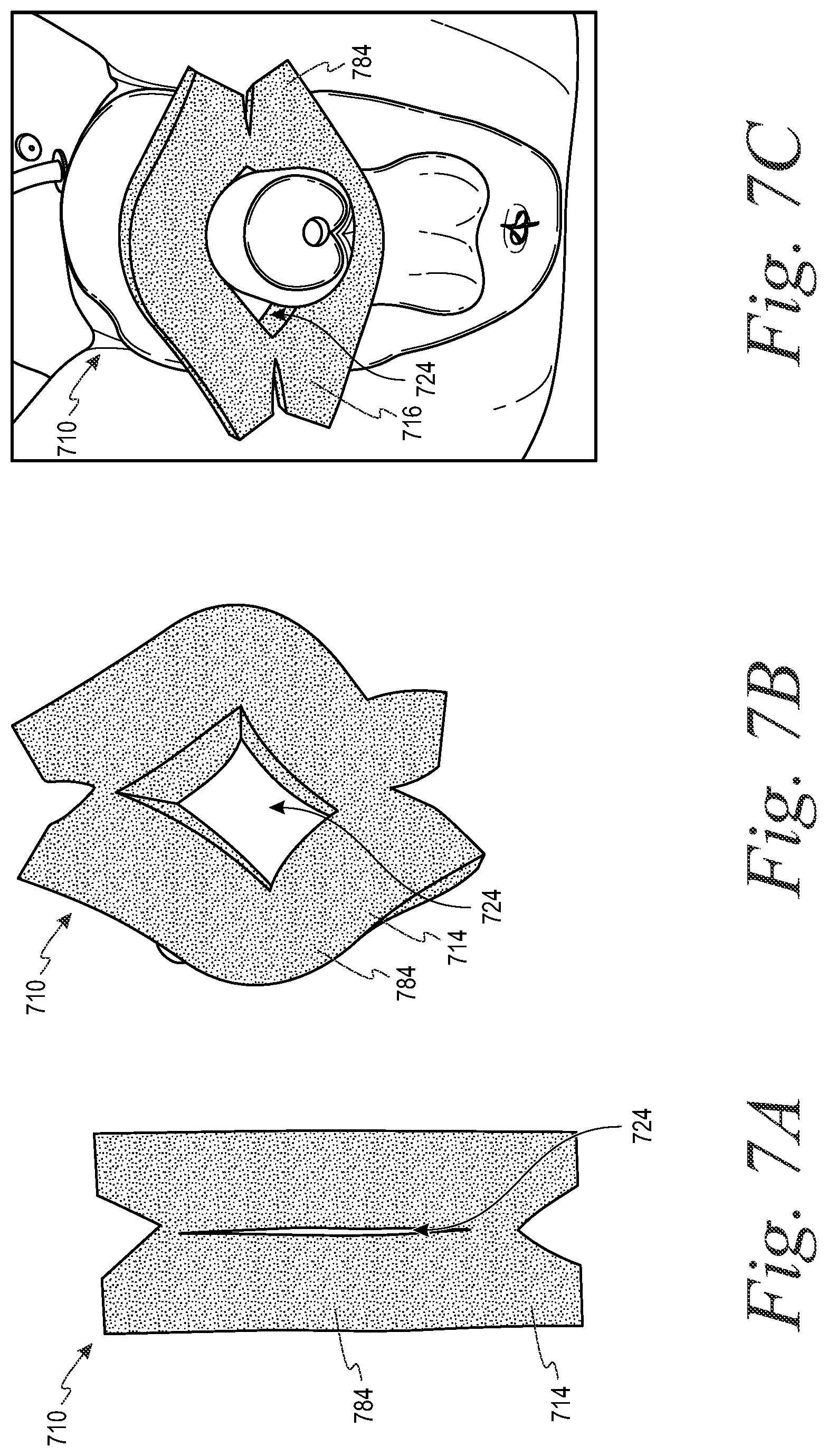 Patent US12090083 Figure 9 – Devices and systems for urine collection