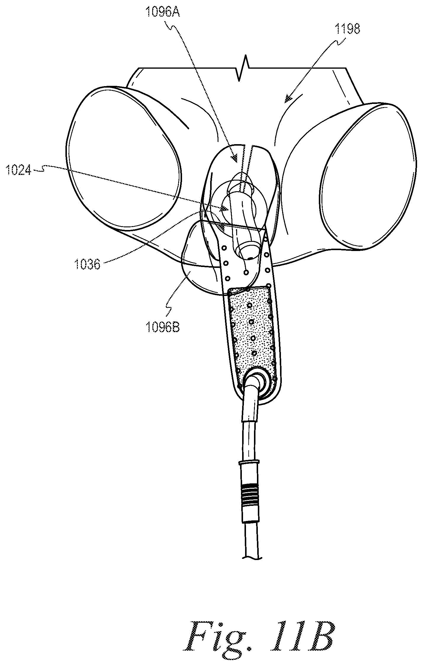 Patent US12090083 Figure 16 – Devices and systems for urine collection