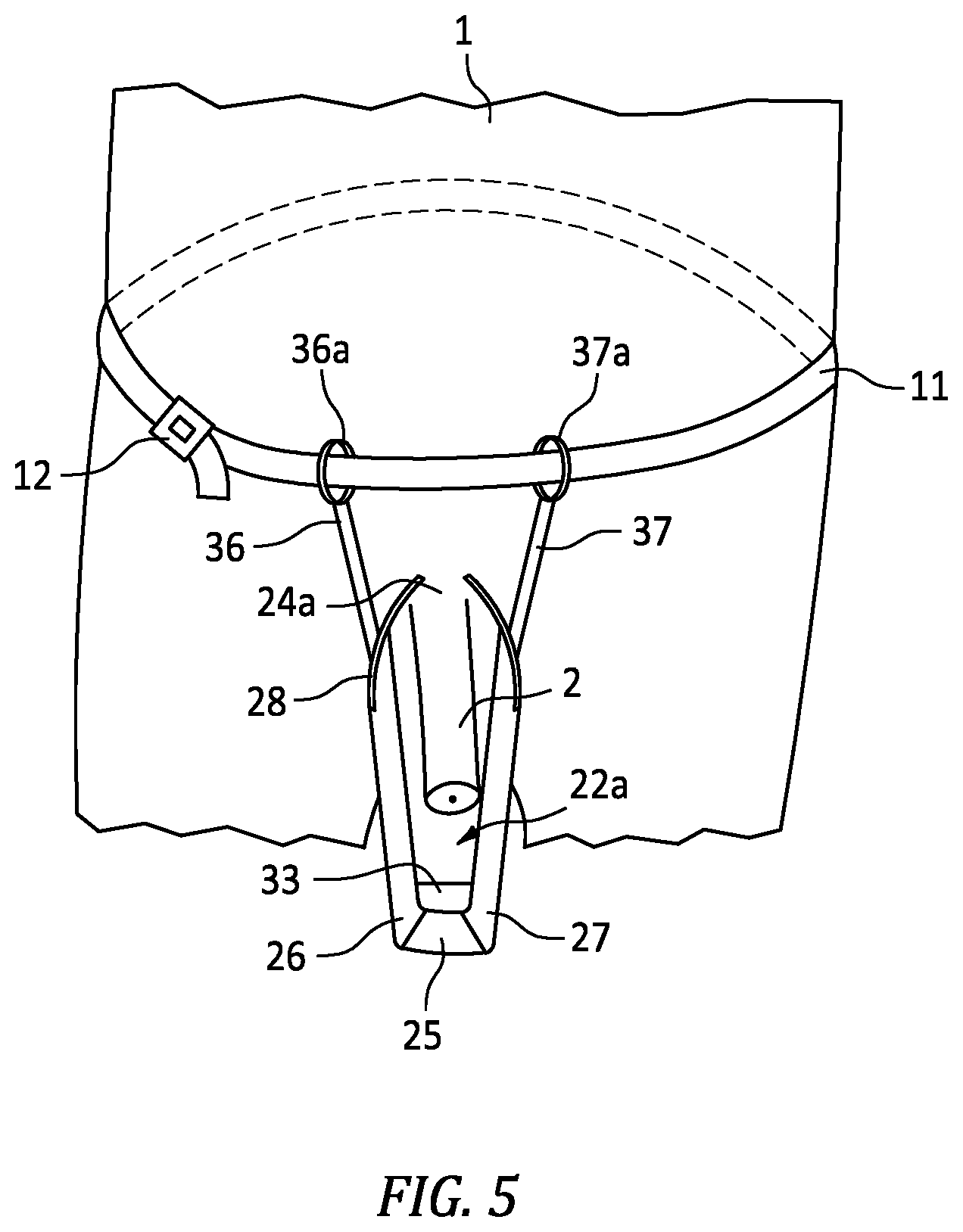 Patent US12090084 Figure 5 – Male incontinence device