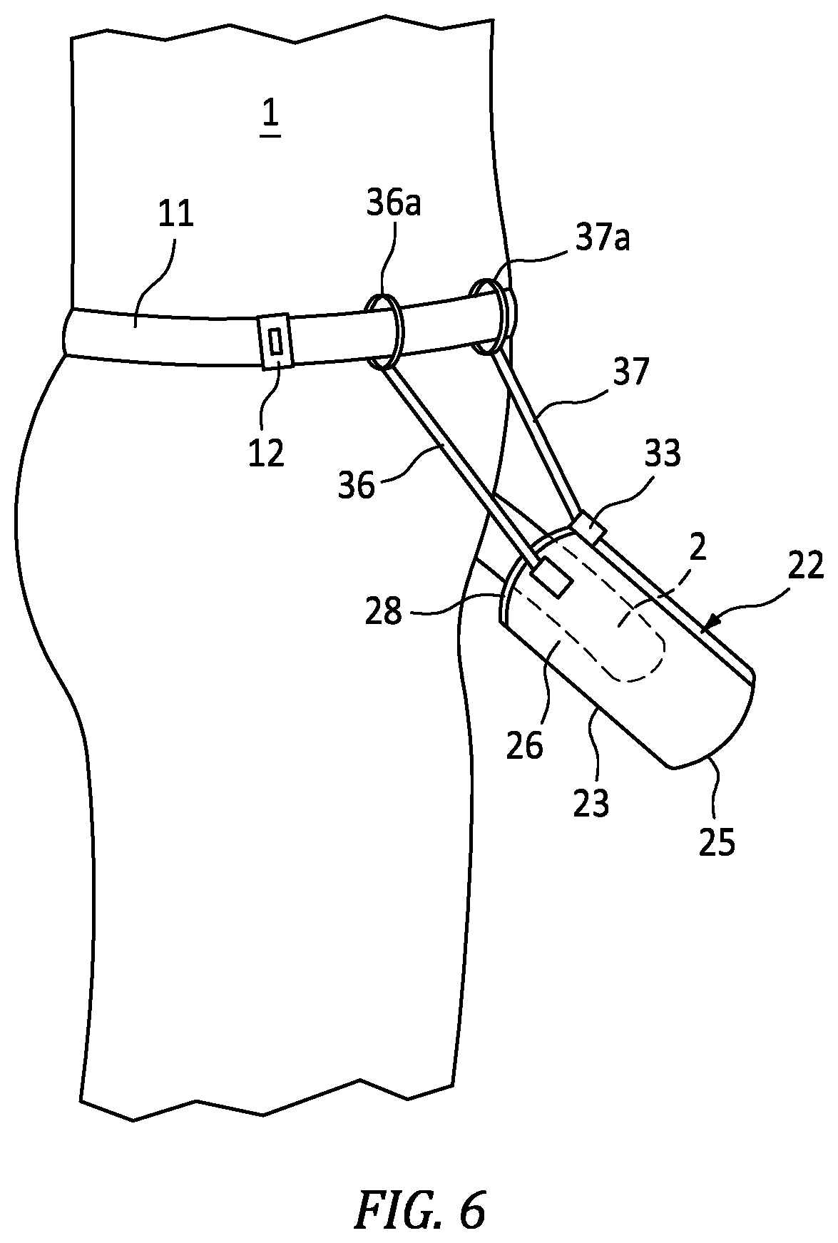 Patent US12090084 Figure 6 – Male incontinence device