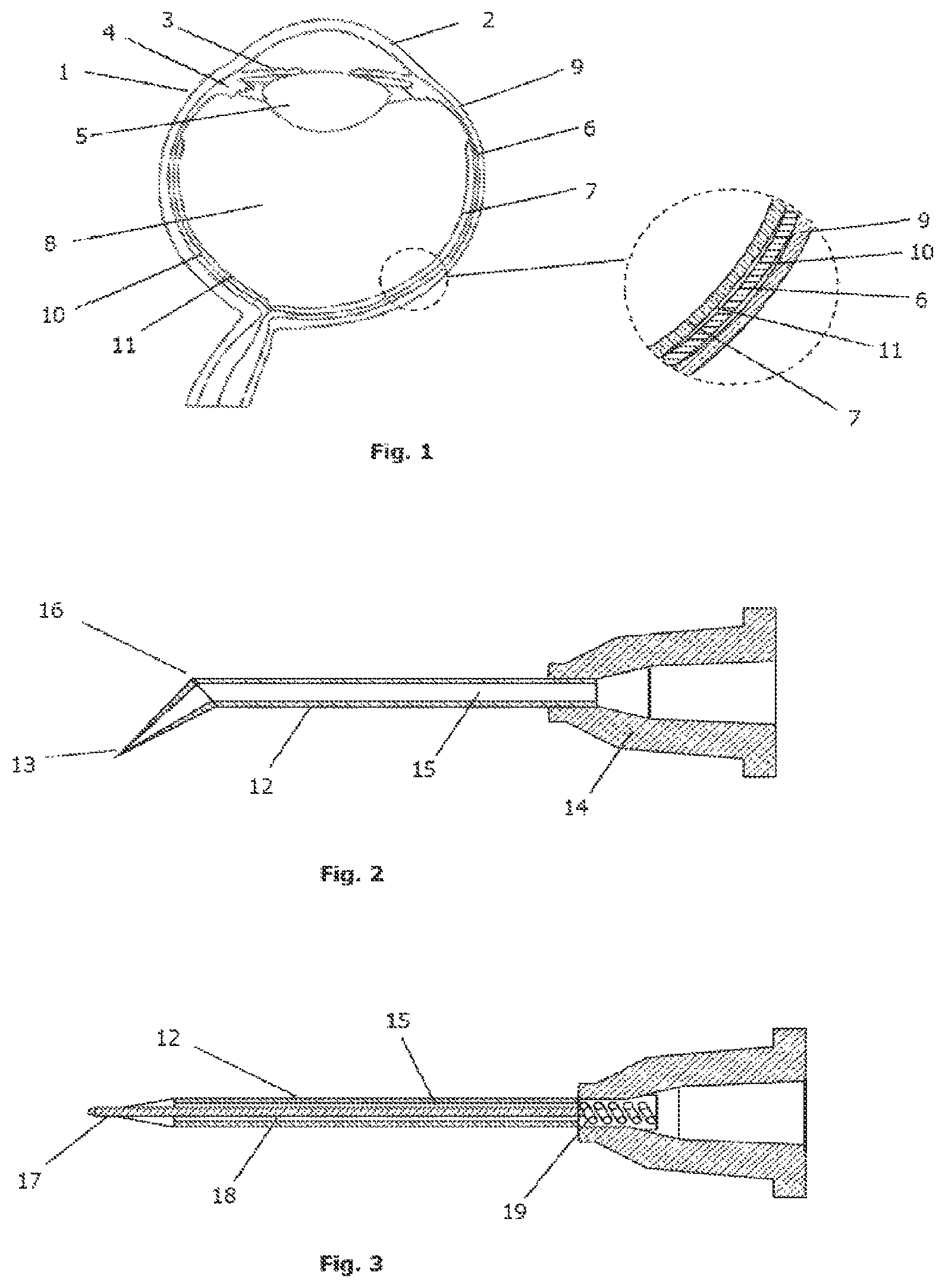 Patent US12090088 Figure 1 – Device for ocular access