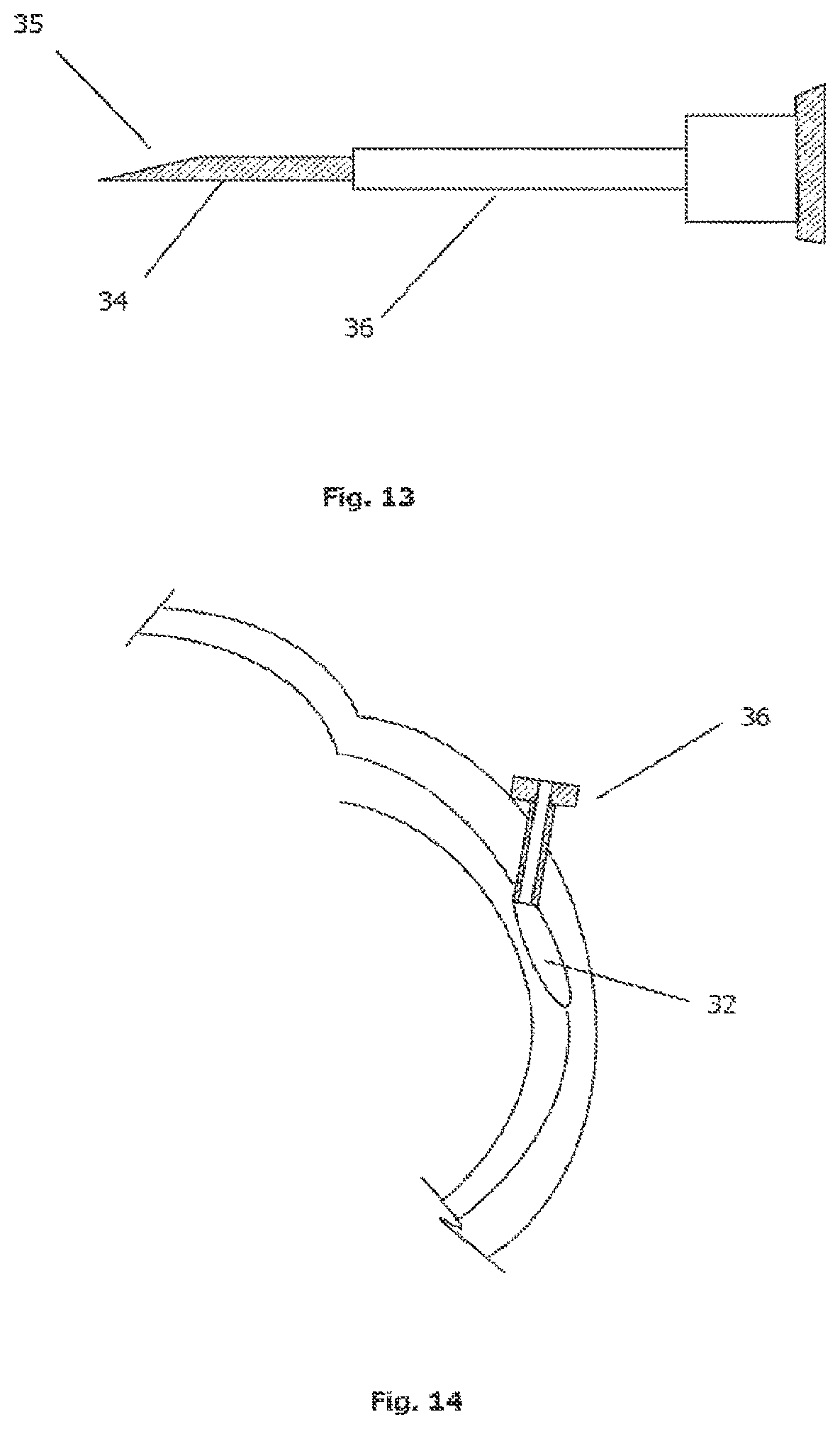 Patent US12090088 Figure 6 – Device for ocular access