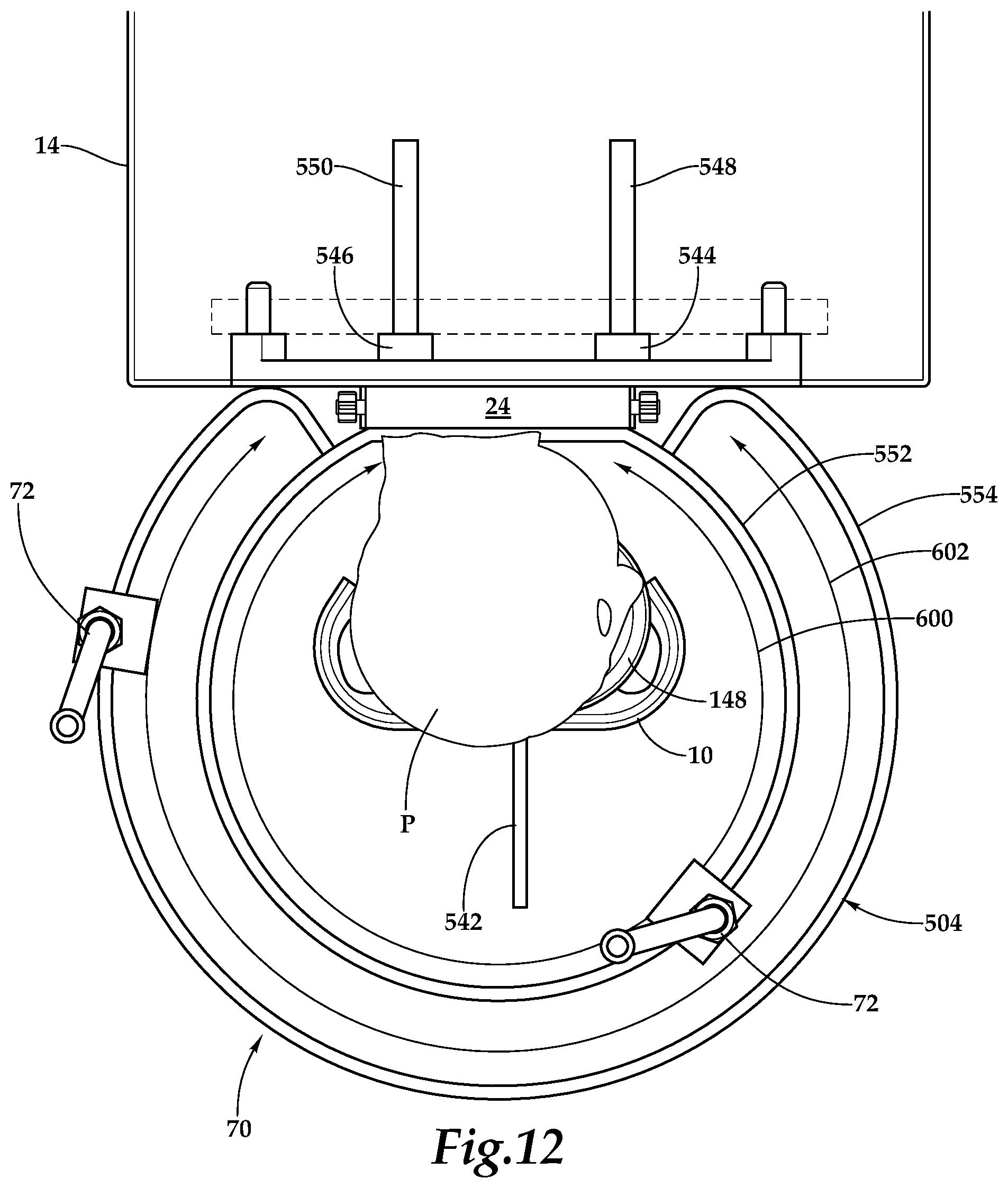 Patent US12090093 Figure 4 – Surgical universal headrest including skull pin holder assembly