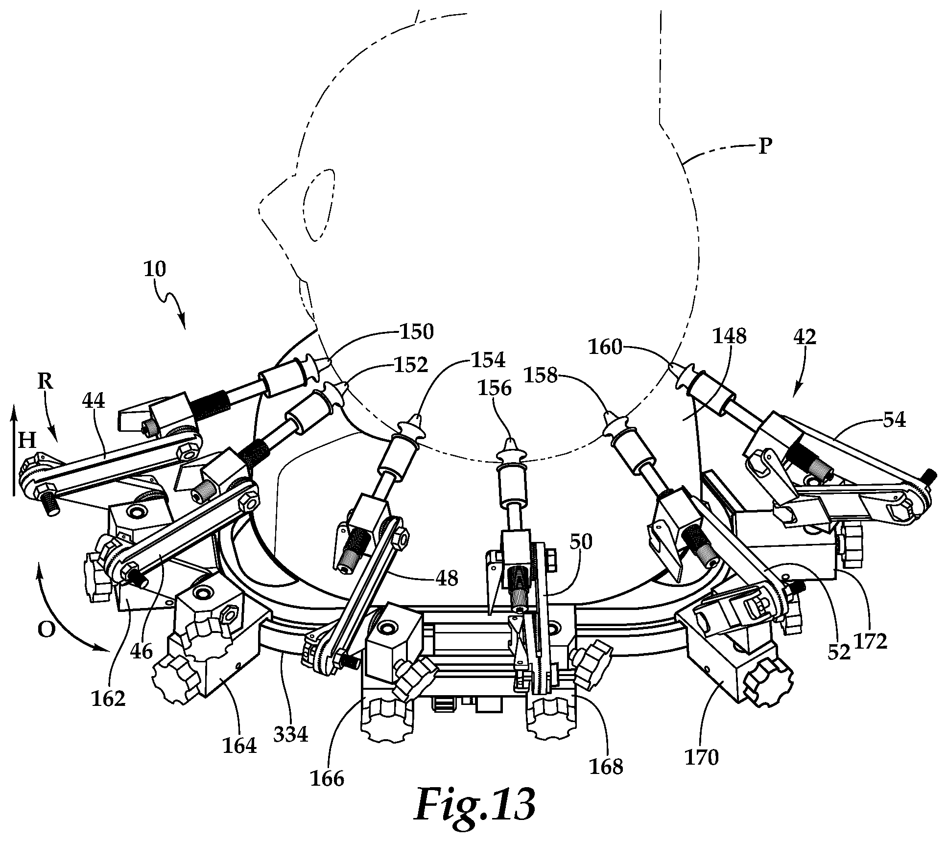 Patent US12090093 Figure 5 – Surgical universal headrest including skull pin holder assembly