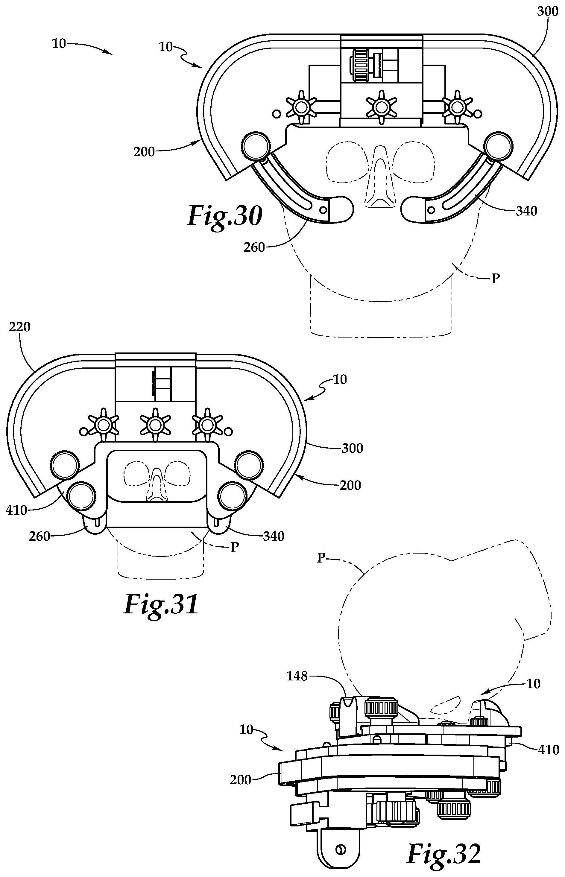 Patent US12090093 Figure 12 – Surgical universal headrest including skull pin holder assembly