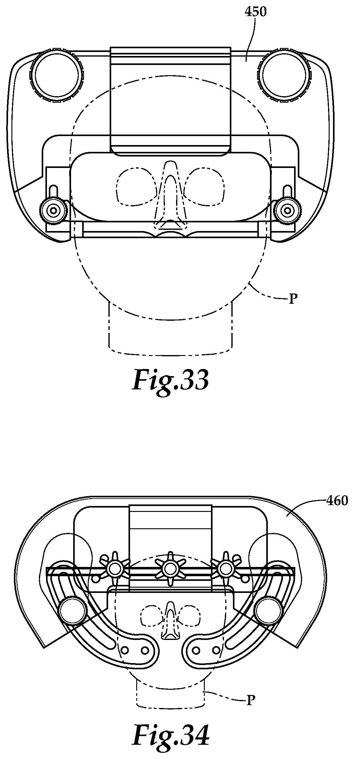 Patent US12090093 Figure 13 – Surgical universal headrest including skull pin holder assembly