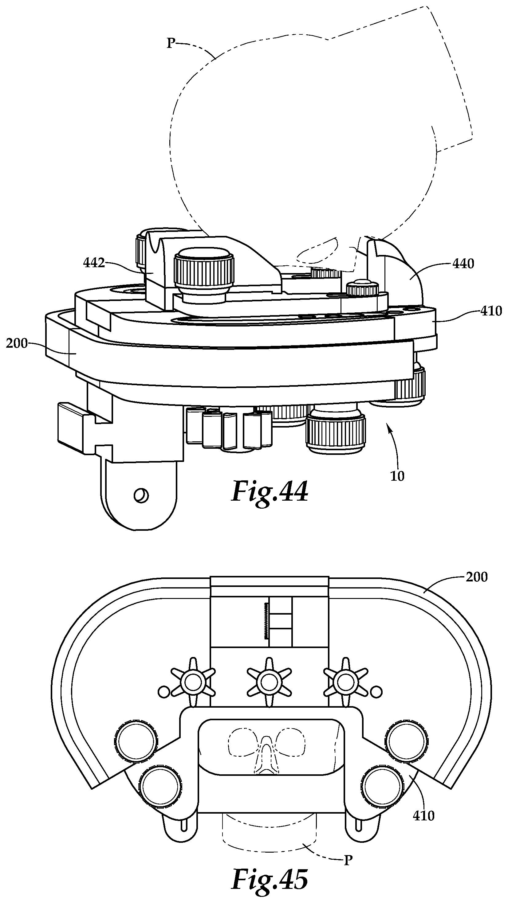 Patent US12090094 Figure 18 – Surgical universal headrest including skull pin holder assembly