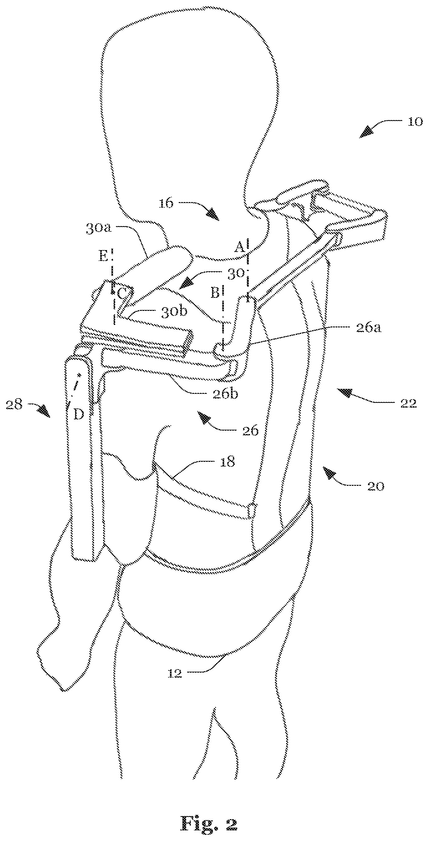 Patent US12090106 Figure 2 – System and method for the reduction of forces acting on an arm of a human
