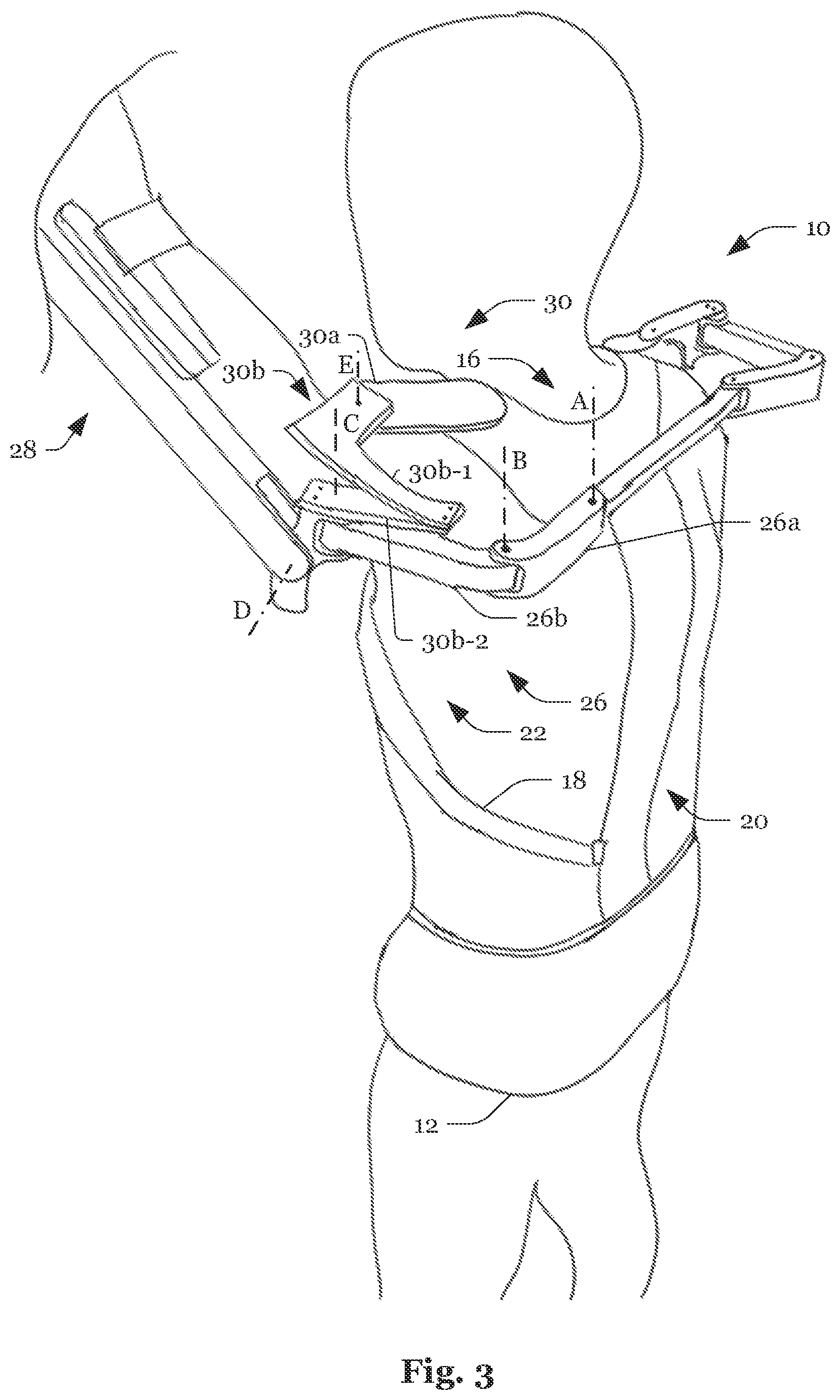 Patent US12090106 Figure 3 – System and method for the reduction of forces acting on an arm of a human