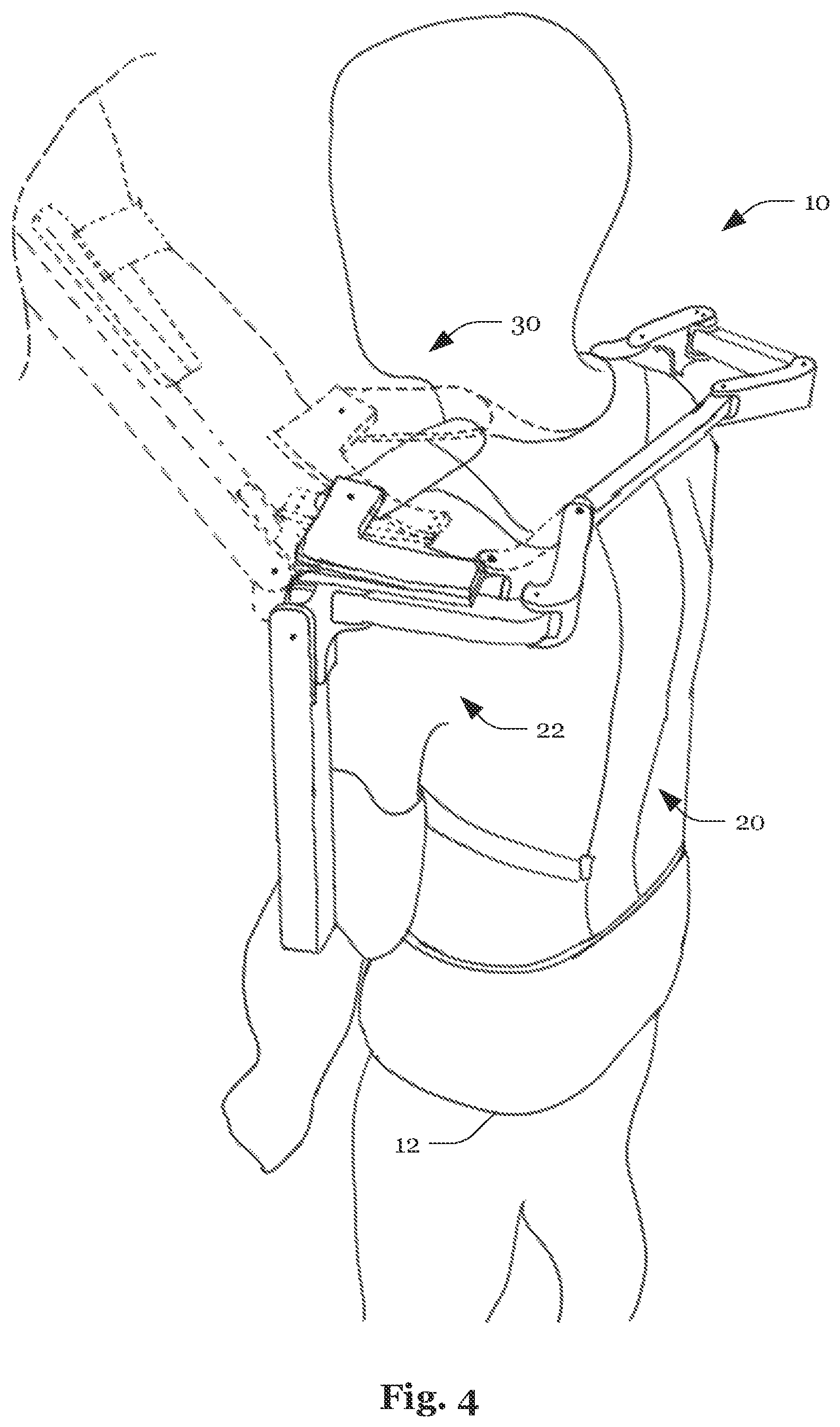 Patent US12090106 Figure 4 – System and method for the reduction of forces acting on an arm of a human