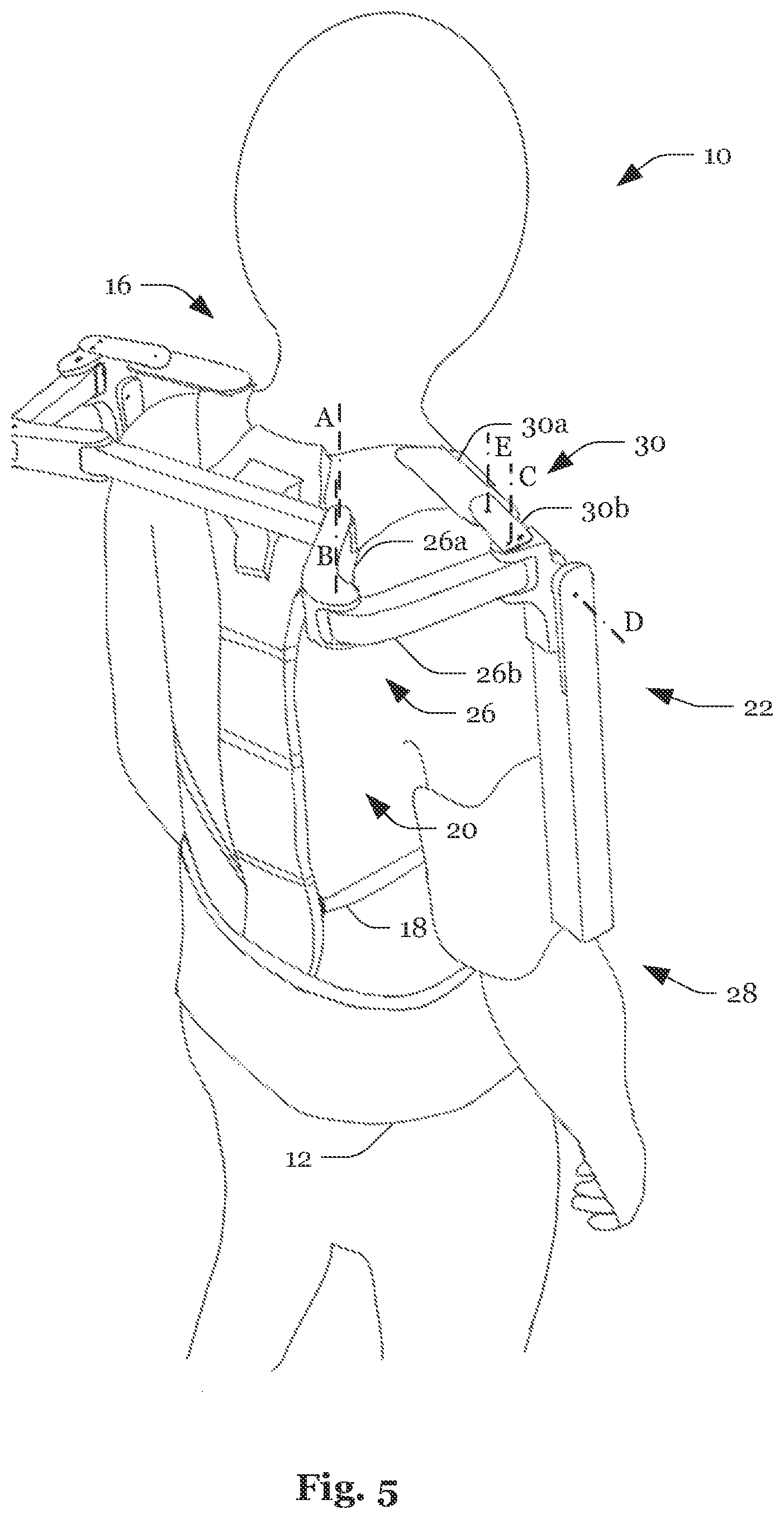 Patent US12090106 Figure 5 – System and method for the reduction of forces acting on an arm of a human