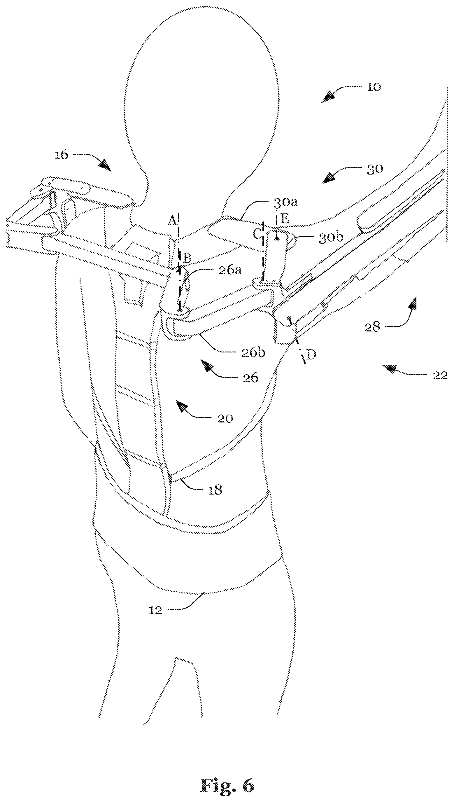 Patent US12090106 Figure 6 – System and method for the reduction of forces acting on an arm of a human