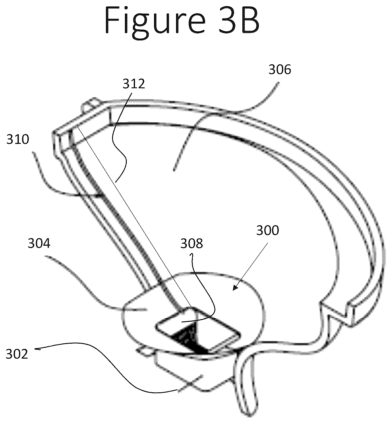 Patent US12090112 Figure 5 – Methods and systems for adaptive treatment of disorders in the gastrointestinal tract