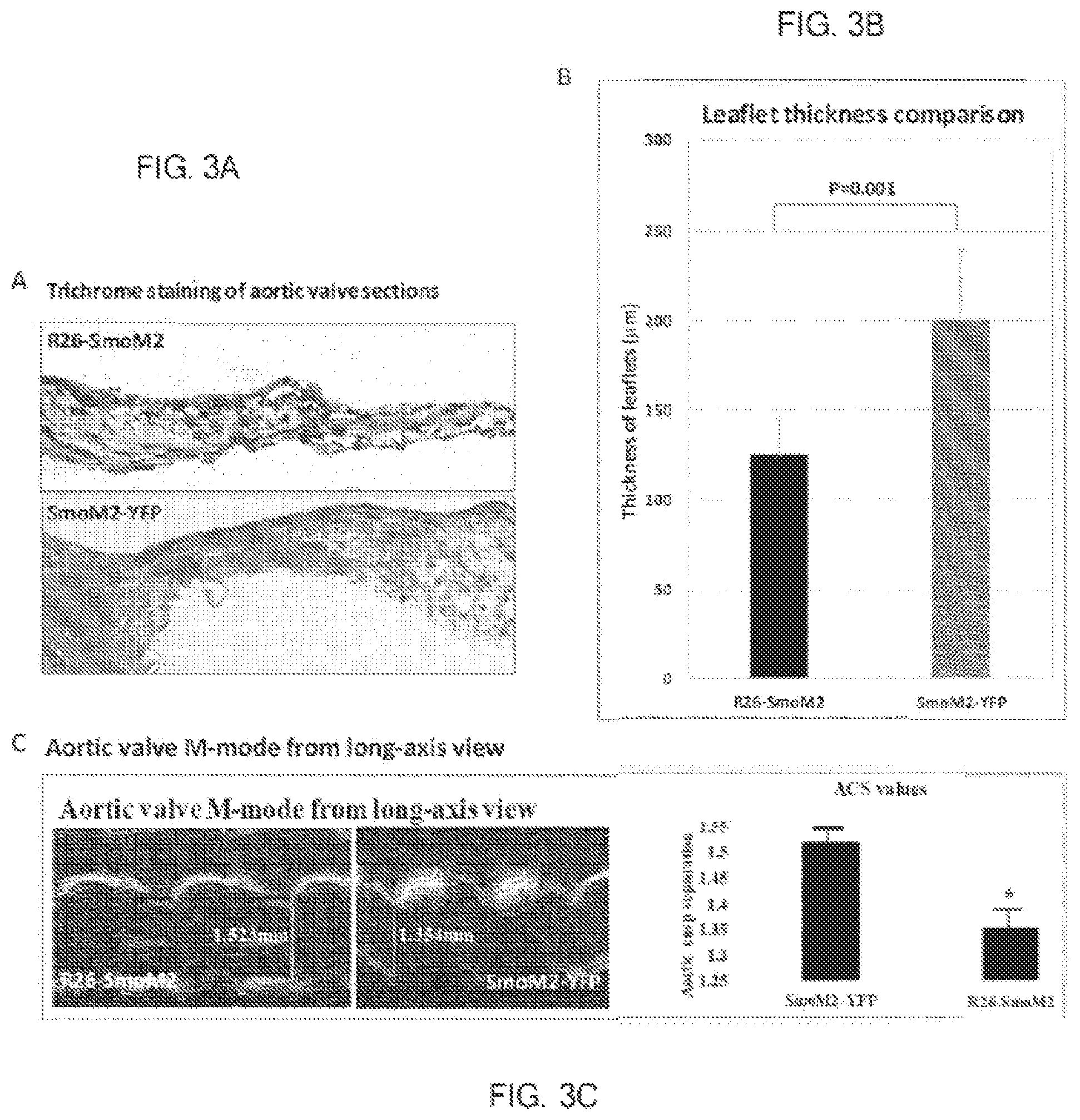 Patent US12090127 Figure 2 – Methods for treating pulmonary fibrosis with a hedgehog pathway inhibitor