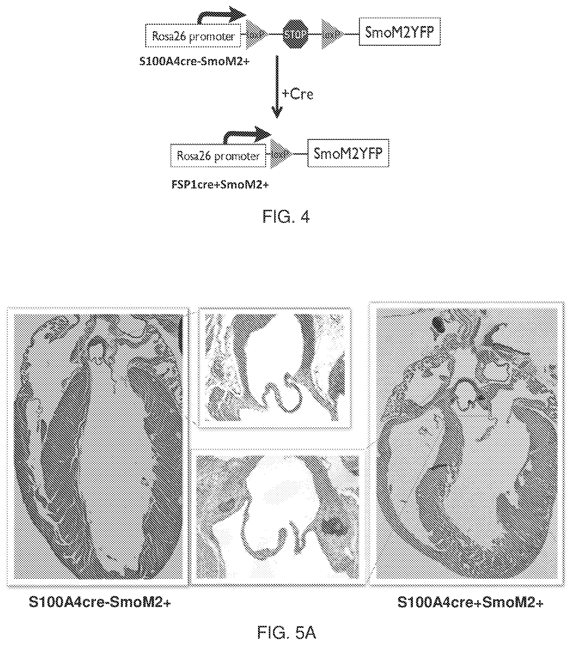 Patent US12090127 Figure 3 – Methods for treating pulmonary fibrosis with a hedgehog pathway inhibitor