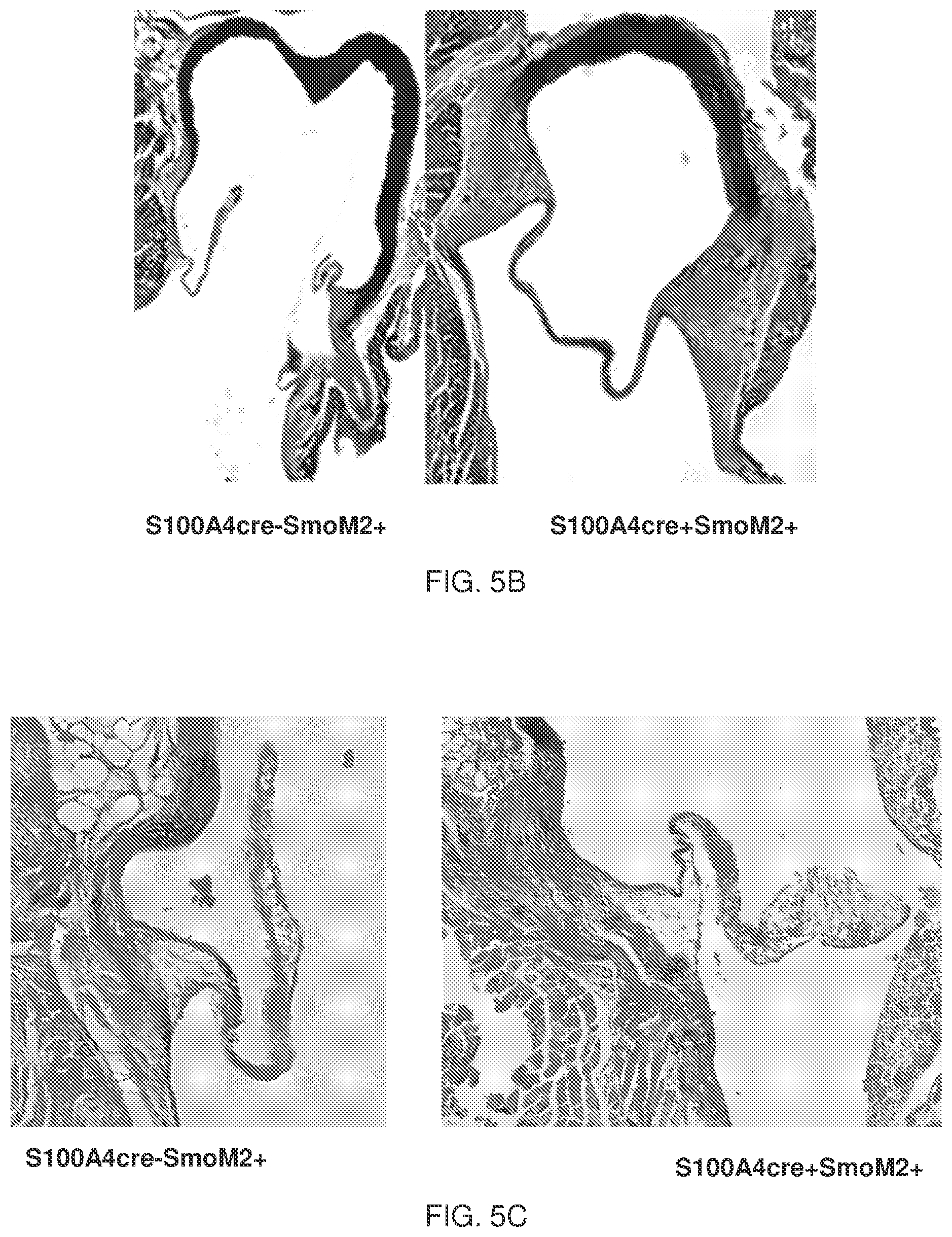 Patent US12090127 Figure 4 – Methods for treating pulmonary fibrosis with a hedgehog pathway inhibitor