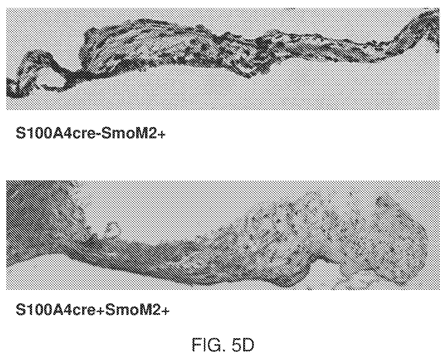 Patent US12090127 Figure 5 – Methods for treating pulmonary fibrosis with a hedgehog pathway inhibitor