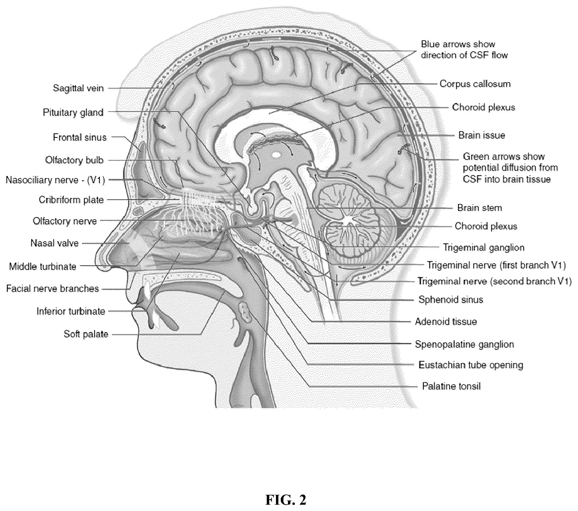 Patent US12090130 Figure 2 – Methods of treating brain disorders